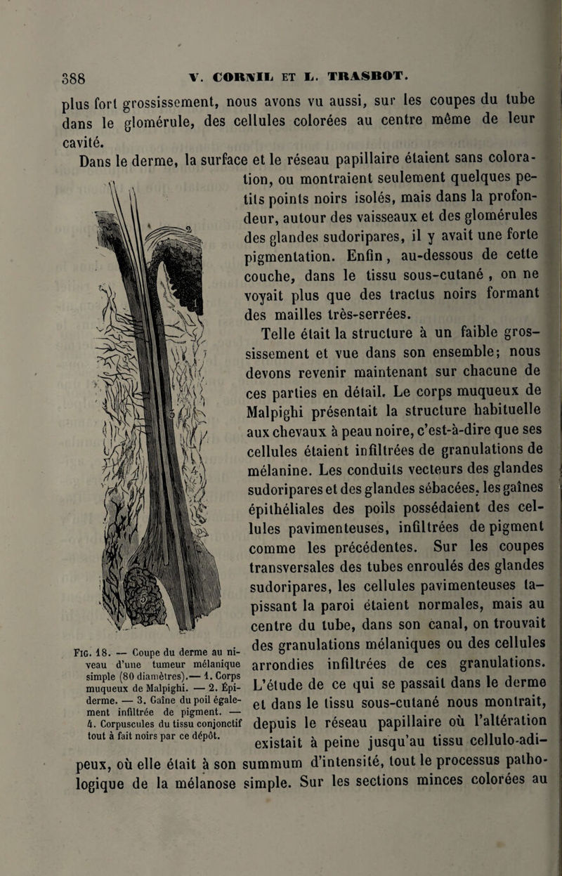 plus fori grossissement, nous avons vu aussi, sur ies coupes du tube dans le glomerule, des cellules colorees au centre m6me de leur cavite. Dans le derme, la surface et le reseau papillaire etaient sans colora¬ tion, ou montraient seulement quelques pe¬ rils points noirs isoles, mais dans la profon- deur, autour des vaisseaux et des glomerules des glandes sudoripares, il y avait une forte pigmentation. Enfin, au-dessous de cette couche, dans le tissu sous-cutane , on ne voyait plus que des tractus noirs formant des mailles Ires-serrees. Telle elait la structure a un faible gros- sissement et vue dans son ensemble; nous devons revenir maintenant sur chacune de ces parties en detail. Le corps muqueux de Malpighi presentait la structure habituelle aux chevaux a peau noire, c’est-a-dire que ses cellules etaient infiltrees de granulations de melanine. Les conduits vecteurs des glandes sudoripares et des glandes sebacees, les gaines epilheliales des poils possedaient des cel¬ lules pavimenteuses, infiltrees de pigment comme les precedentes. Sur les coupes transversales des tubes enroules des glandes sudoripares, les cellules pavimenteuses la- pissant la paroi etaient normales, mais au centre du tube, dans son canal, on trouvait des granulations melaniques ou des cellules . VJ • XVJ* V4UUWV VAU VIVA AA»V MM »»» ^ m veau d’une tumeur meianique arrondies infiltrees de ces granulations. -VeX L’elude de ce qui se passait dans le derme derme. — 3. Gaine dupoilegale- ^ (jang ljs§u SOUS-Clltane nOUS montrait, ment infiltree de pigment. — . ^ , ,, . , 4. Corpuscuies du tissu conjonctif depuis le reseau papillaire ou 1 alteration tout a fait noirs par ce ddpot. exigtait ^ peine jusqu’au tisSU CellulO-adi- peux, oil elle elait a son summum d’intensite, tout le processus patho- logique de la melanose simple. Sur les sections minces colorees au Fig. 18. — Coupe du derme au ni-