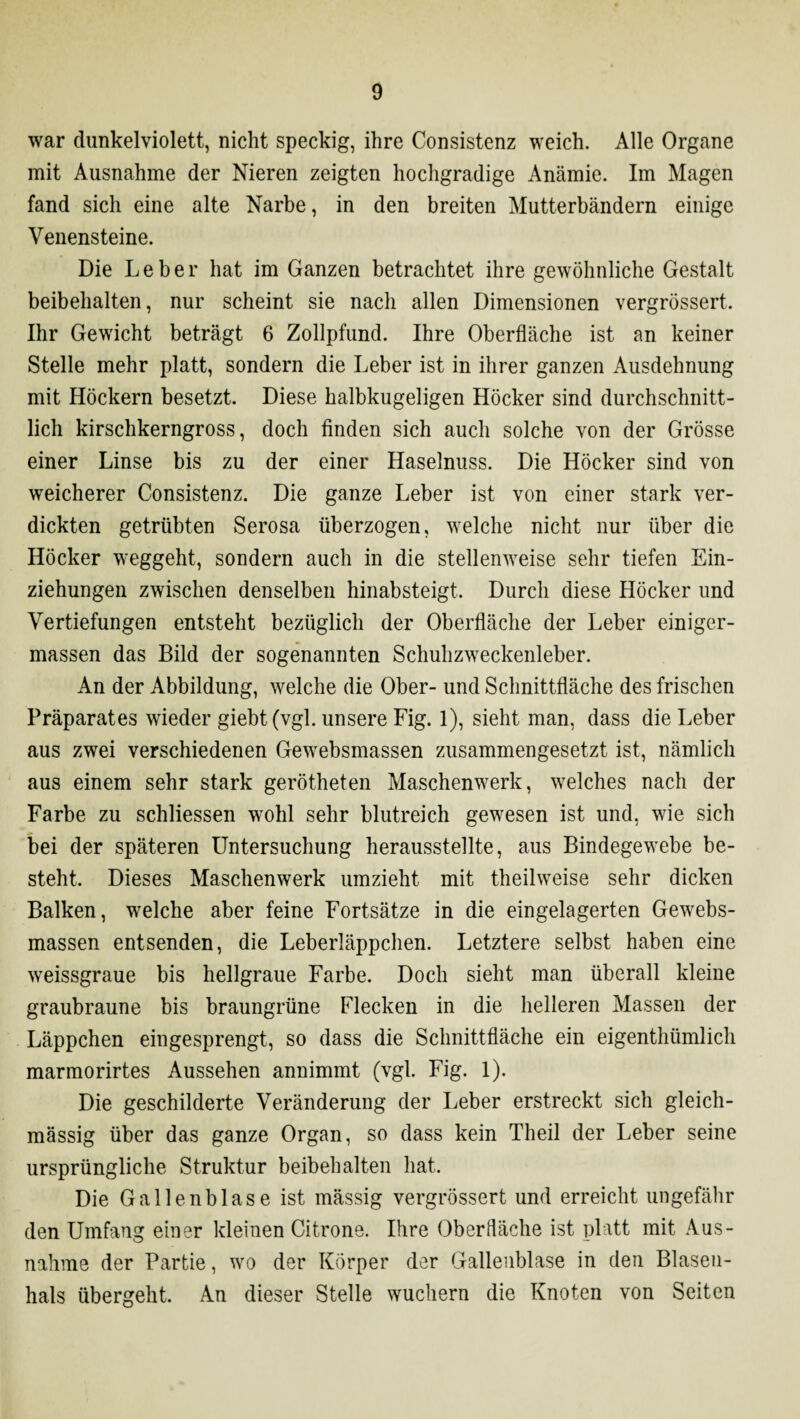 war dunkelviolett, nicht speckig, ihre Consistenz weich. Alle Organe mit Ausnahme der Nieren zeigten hochgradige Anämie. Im Magen fand sich eine alte Narbe, in den breiten Mutterbändern einige Venensteine. Die Leber hat im Ganzen betrachtet ihre gewöhnliche Gestalt beibehalten, nur scheint sie nach allen Dimensionen vergrössert. Ihr Gewicht beträgt 6 Zollpfund. Ihre Oberfläche ist an keiner Stelle mehr platt, sondern die Leber ist in ihrer ganzen Ausdehnung mit Höckern besetzt. Diese halbkugeligen Höcker sind durchschnitt¬ lich kirschkerngross, doch finden sich auch solche von der Grösse einer Linse bis zu der einer Haselnuss. Die Höcker sind von weicherer Consistenz. Die ganze Leber ist von einer stark ver¬ dickten getrübten Serosa überzogen, welche nicht nur über die Höcker weggeht, sondern auch in die stellenweise sehr tiefen Ein¬ ziehungen zwischen denselben hinabsteigt. Durch diese Höcker und Vertiefungen entsteht bezüglich der Oberfläche der Leber einiger- massen das Bild der sogenannten Schuhzweckenleber. An der Abbildung, welche die Ober- und Schnittfläche des frischen Präparates wieder giebt(vgl. unsere Fig. 1), sieht man, dass die Leber aus zwei verschiedenen Gewebsmassen zusammengesetzt ist, nämlich aus einem sehr stark gerötheten Maschenwerk, welches nach der Farbe zu schliessen wohl sehr blutreich gewesen ist und, wie sich bei der späteren Untersuchung herausstellte, aus Bindegewebe be¬ steht. Dieses Maschenwerk umzieht mit theilweise sehr dicken Balken, welche aber feine Fortsätze in die eingelagerten Gewebs¬ massen entsenden, die Leberläppchen. Letztere selbst haben eine weissgraue bis hellgraue Farbe. Doch sieht man überall kleine graubraune bis braungrüne Flecken in die helleren Massen der Läppchen eingesprengt, so dass die Schnittfläche ein eigenthümlich marmorirtes Aussehen annimmt (vgl. Fig. 1). Die geschilderte Veränderung der Leber erstreckt sich gleich- massig über das ganze Organ, so dass kein Theil der Leber seine ursprüngliche Struktur beibehalten hat. Die Gallenblase ist massig vergrössert und erreicht ungefähr den Umfang einer kleinen Citrone. Ihre Oberfläche ist platt mit Aus¬ nahme der Partie, wo der Körper der Gallenblase in den Blasen- hals übergeht. An dieser Stelle wuchern die Knoten von Seiten