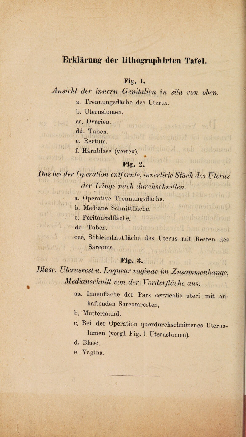 Erklärung der lithographirten Tafel, Fig. 1. Ansicht der innern GenitalicM in situ von oben. a. Trennungsfläche des Uterus. b. Uteruslumen. cc, Ovarien, dd. Tuben. e. Rectum. f. Harnblase (vertex). Fiar. 2. Bas lei der Operation entfernte, invertirte Stück des Uterus der Länge nach durchschniUen. a. Operative Trennungsfläohe. b. Mediane Schnittfläche. c. Peritonealfläche, dd. Tuben. eee. Schleimhautflächo des Uterus mit Resten des Sarcoms. Fig*. 3. Blase, Uterusrest u. Laquear vaginae im Zusammenhänge, Medianschnitt von der Vorderfläche aus. aa. Innenfläche der Pars cervicalis uteri mit an¬ haftenden Sarcomresten. b. Muttermund. c. Bei der Operation querdurchschnittenes Uterus¬ lumen (vergl. Fig. 1 Uteruslumen). d. Blase. e. Vagina.