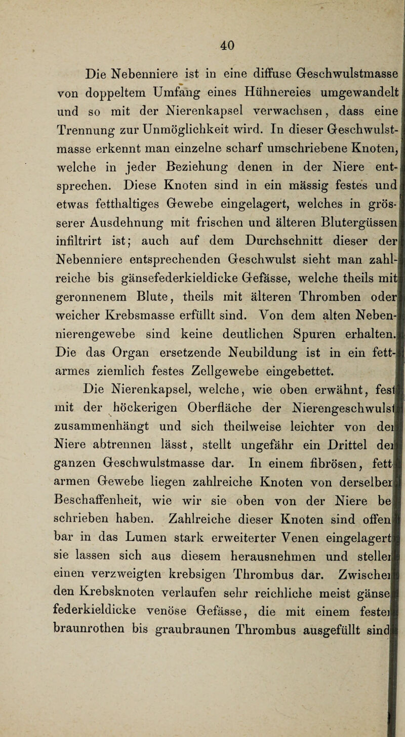 Die Nebenniere ist in eine diffuse Geschwulstmasse von doppeltem Umfang eines Hühnereies umgewandelt und so mit der Nierenkapsel verwachsen, dass eine Trennung zur Unmöglichkeit wird. In dieser Geschwulst¬ masse erkennt man einzelne scharf umschriebene Knoten, welche in jeder Beziehung denen in der Niere ent¬ sprechen. Diese Knoten sind in ein massig festes und etwas fetthaltiges Gewebe eingelagert, welches in grös¬ serer Ausdehnung mit frischen und älteren Blutergüssen infiltrirt ist; auch auf dem Durchschnitt dieser der Nebenniere entsprechenden Geschwulst sieht man zahl¬ reiche bis gänsefederkieldicke Gefässe, welche theils mit geronnenem Blute, theils mit älteren Thromben oder weicher Krebsmasse erfüllt sind. Von dem alten Neben¬ nierengewebe sind keine deutlichen Spuren erhalten. Die das Organ ersetzende Neubildung ist in ein fett¬ armes ziemlich festes Zellgewebe eingebettet. Die Nierenkapsel, welche, wie oben erwähnt, festj mit der höckerigen Oberfläche der NierengeschwulsfJ zusammenhängt und sich theilweise leichter von deif Niere abtrennen lässt, stellt ungefähr ein Drittel deil ganzen Geschwulstmasse dar. In einem fibrösen, fettI armen Gewebe liegen zahlreiche Knoten von derselberl Beschaffenheit, wie wir sie oben von der Niere bei schrieben haben. Zahlreiche dieser Knoten sind offen« bar in das Lumen stark erweiterter Venen eingelagertM sie lassen sich aus diesem herausnehmen und stelleij einen verzweigten krebsigen Thrombus dar. Zwischei* den Krebsknoten verlaufen sehr reichliche meist gänsefi federkieldicke venöse Gefässe, die mit einem feste« braunrothen bis graubraunen Thrombus ausgefüllt sindp