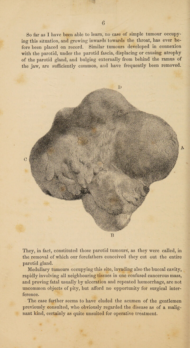 So far as I have been able to learn, no case of simple tumour occupy¬ ing this situation, and growing inwards towards the throat, has ever be¬ fore been placed on record. Similar tumours developed in connexion with the parotid, under the parotid fascia, displacing or causing atrophy of the parotid gland, and bulging externally from behind the ramus of the jaw, are sufficiently common, and have frequently been removed. They, in fact, constituted those parotid tumours', as they were called, in the removal of which our forefathers conceived they cut out the entire parotid gland. Medullary tumours occupying this site, invading also the buccal cavity, rapidly involving all neighbouring tissues in one confused cancerous mass, and proving fatal usually by ulceration and repeated haemorrhage, are not uncommon objects of pity, but afford no opportunity for surgical inter¬ ference. The case further seems to have eluded the acumen of the gentlemen previously consulted, who obviously regarded the disease as of a malig¬ nant kind, certainly as quite unsuited for operative treatment.
