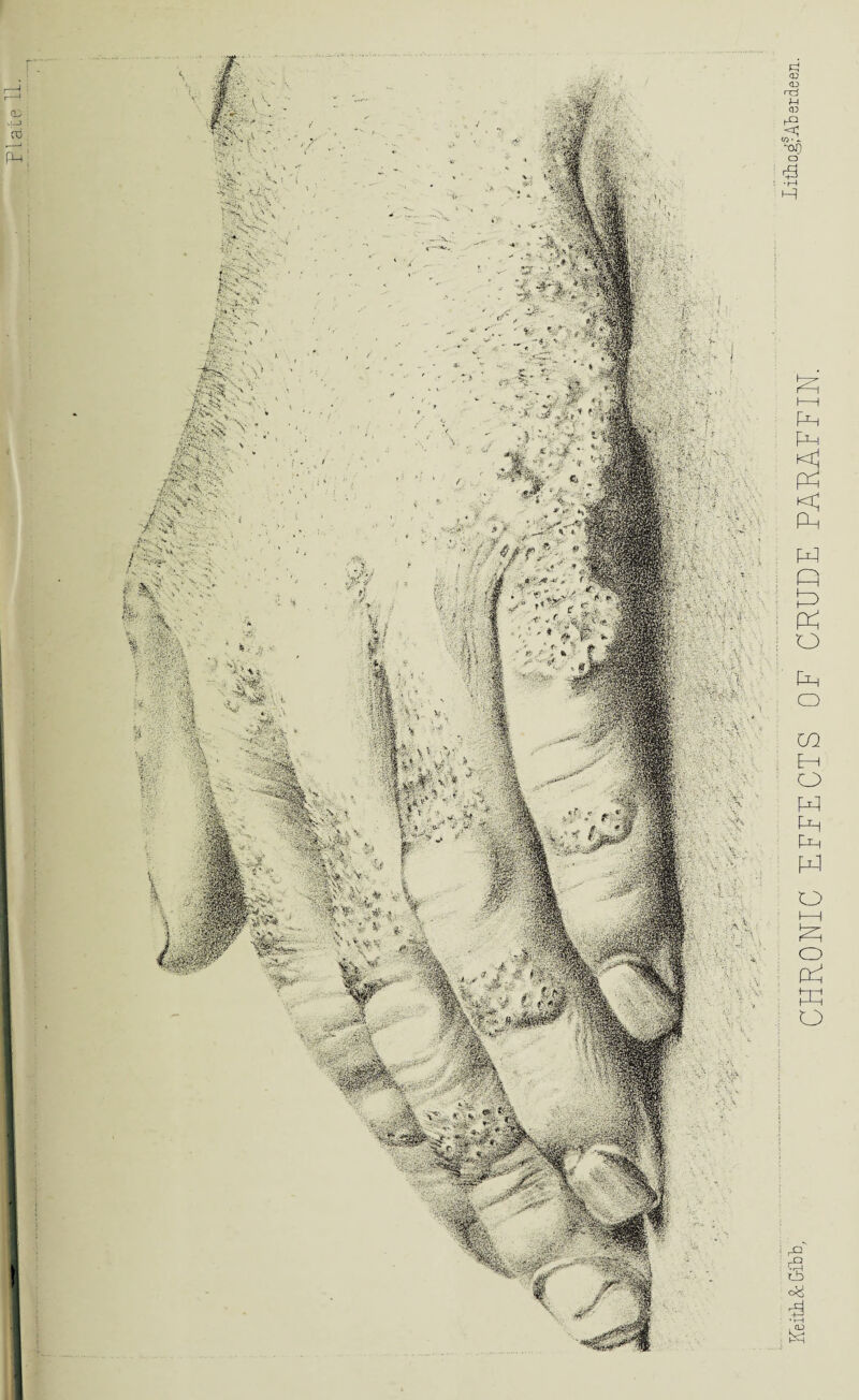 Plate CHRONIC EFFECTS OF CRUDE PARAFFIN.