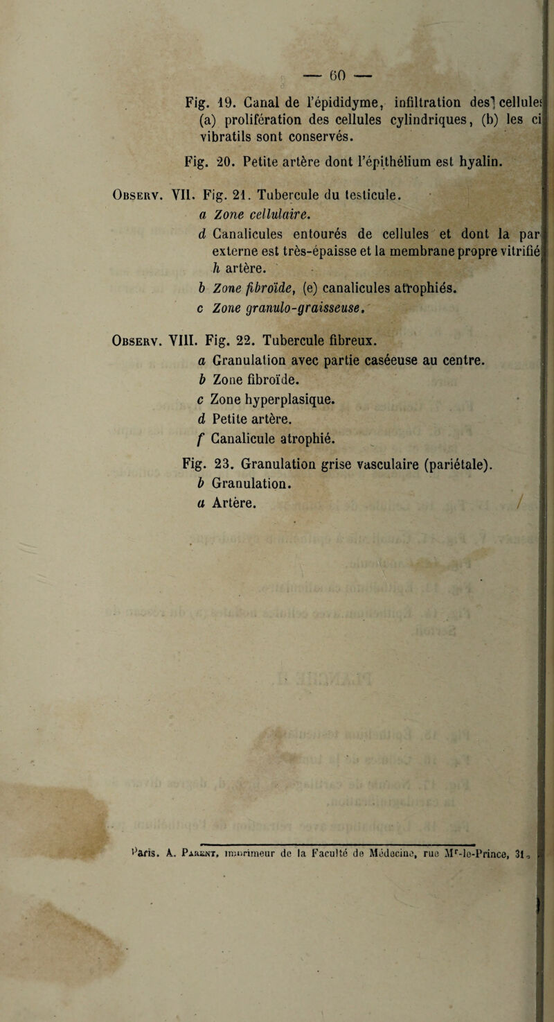 Fig. 19. Canal de l’épididyme, infiltration des] cellules (a) prolifération des cellules cylindriques, (b) les ci vibratils sont conservés. Fig. 20. Petite artère dont l’épithélium est hyalin. Observ. Vil. Fig. 21. Tubercule du testicule. a Zone cellulaire. d Ganalicules entourés de cellules et dont la par externe est très-épaisse et la membrane propre vitrifié h artère. b Zone fibrdide, (e) canalicules atrophiés, c Zone granulo-graisseuse. Observ. YIII. Fig. 22. Tubercule fibreux. a Granulation avec partie caséeuse au centre. b Zone fibroïde. c Zone hyperplasique. d Petite artère. f Ganalicule atrophié. Fig. 23. Granulation grise vasculaire (pariétale). b Granulation. a Artère. '^aris. A., Parsnt, injnrimeur de la Faculté de Médecine, rue Af-lo-Prince, 31,