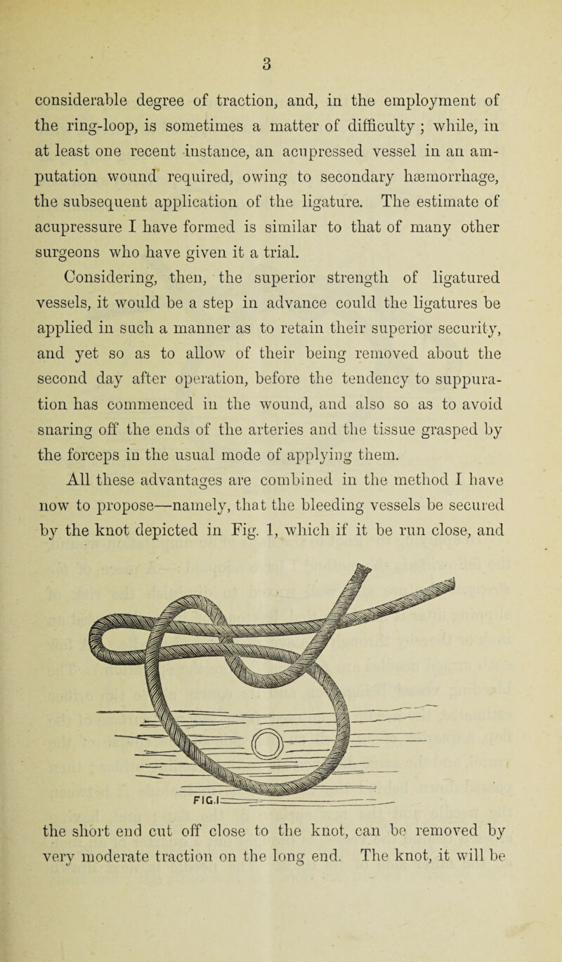 considerable degree of traction, and, in the employment of the ring-loop, is sometimes a matter of difficulty ; while, in at least one recent instance, an acnpressed vessel in an am¬ putation wound required, owing to secondary haemorrhage, the subsequent application of the ligature. The estimate of acupressure I have formed is similar to that of many other surgeons who have given it a trial. Considering, then, the superior strength of ligatured vessels, it would be a step in advance could the ligatures be applied in such a manner as to retain their superior security, and yet so as to allow of their being removed about the second day after operation, before the tendency to suppura¬ tion has commenced in the wound, and also so as to avoid snaring off the ends of the arteries and the tissue grasped by the forceps in the usual mode of applying them. All these advantages are combined in the method I have now to propose—namely, that the bleeding vessels be secured by the knot depicted in Fig. 1, which if it be run close, and FIG.I— the short end cut off close to the knot, can be removed by very moderate traction on the long end. The knot, it will be