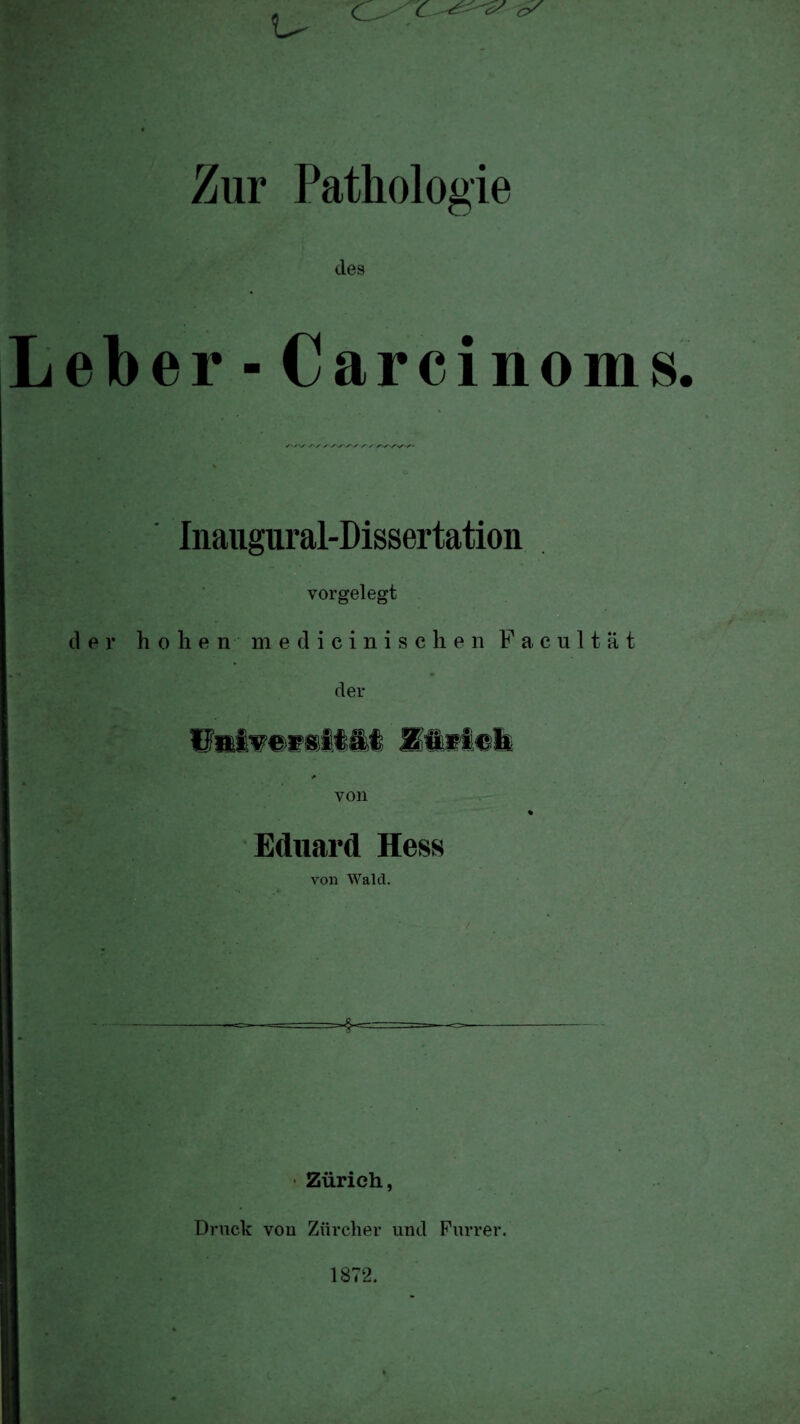 u Zur Pathologie des Leber - Carcinoms. Inaugural-Dissertation vorgelegt der hohen medicinischen Facultät der von Eduard Hess von Walcl. ■ Zürich, Druck von Zürcher und Purrer. 1872.