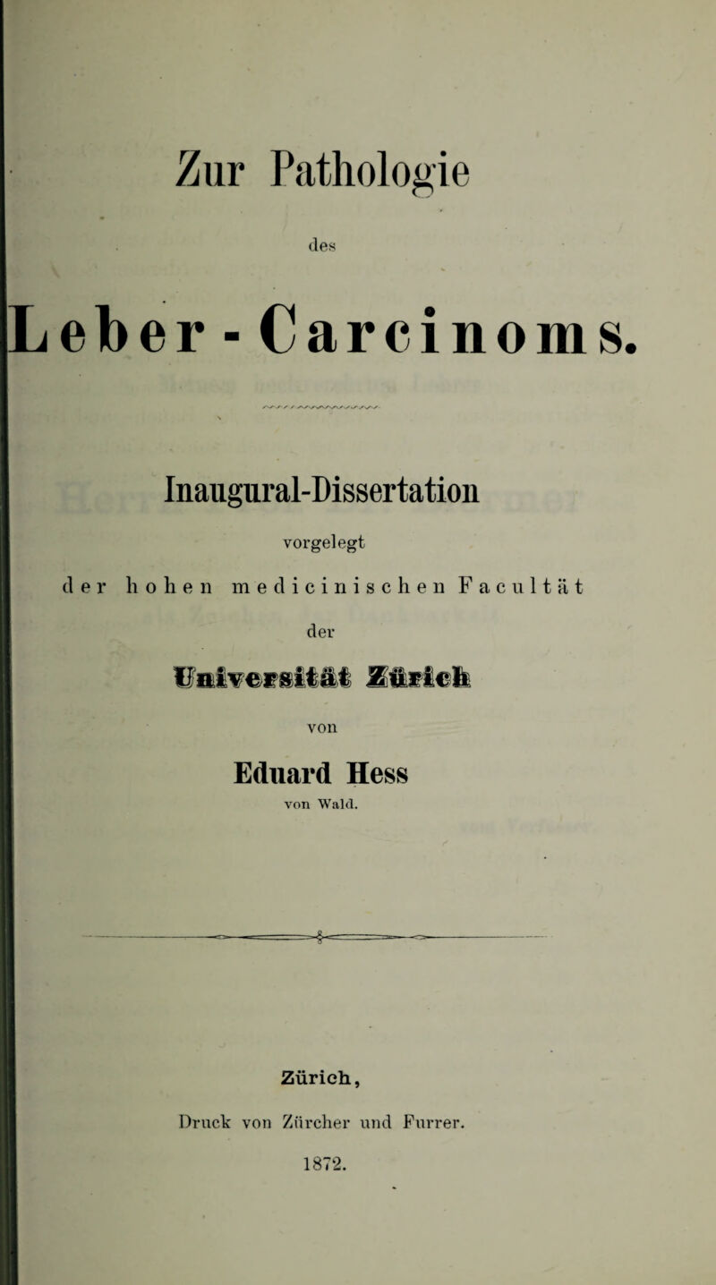 Zur Pathologie des eber - Carcinoms. Inaugural-Dissertation vorgelegt der hohen medicinischen Facultät der (Jaivecsität Zürich von Eduard Hess von Wald. HH Zürich, Druck von Zürcher und Furrer. 1872.