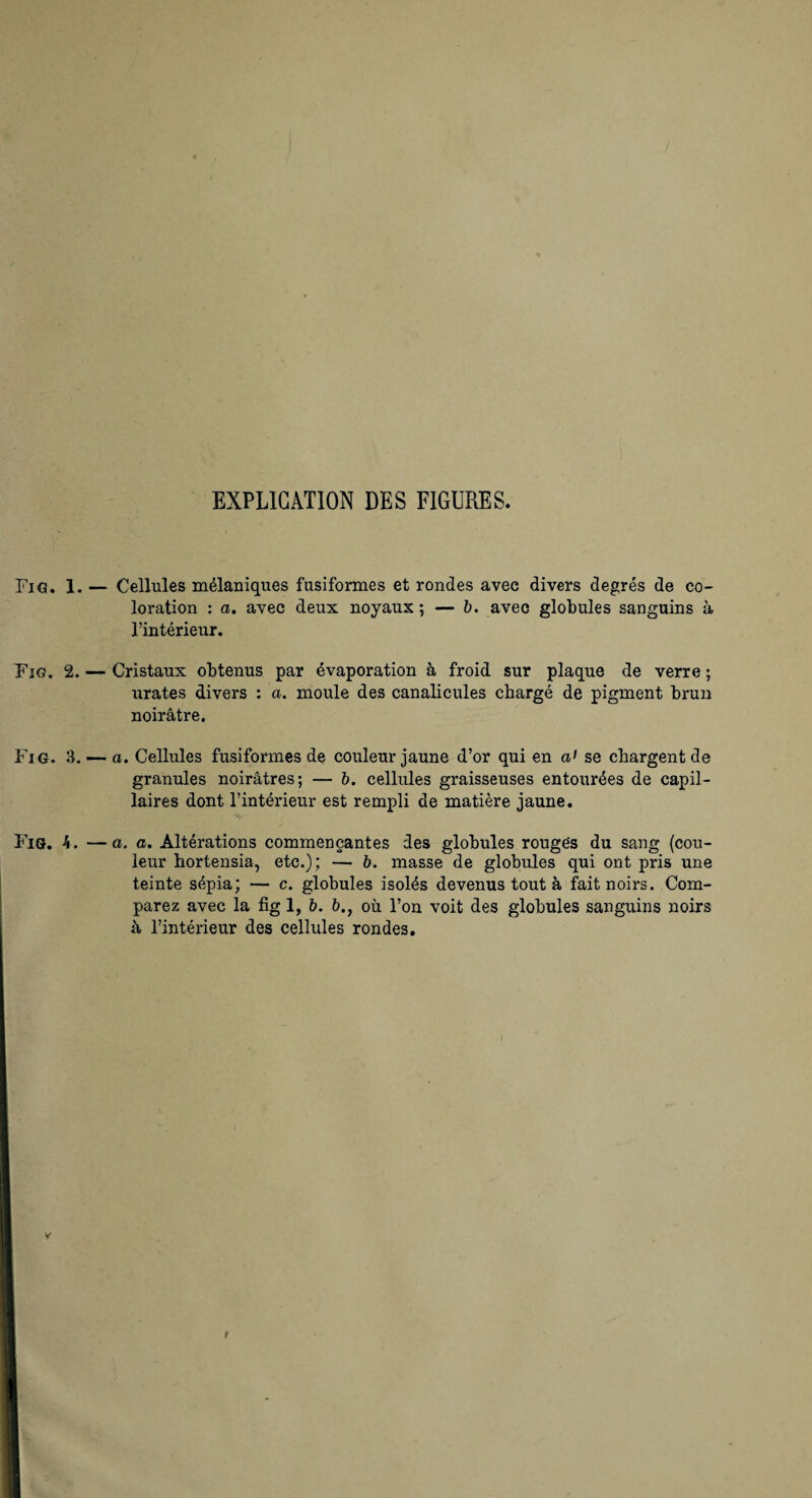 EXPLICATION DES FIGURES. Fig. 1. Fig. 2. Fig. 3. Fig. 4. — Cellules mélaniques fusiformes et rondes avec divers degrés de co¬ loration : a. avec deux noyaux ; — h, avec globules sanguins à l’intérieur. — Cristaux obtenus par évaporation à froid sur plaque de verre ; urates divers : a. moule des canalicules chargé de pigment brun noirâtre. —- a. Cellules fusiformes de couleur jaune d’or qui en a' se chargent de granules noirâtres; — h. cellules graisseuses entourées de capil¬ laires dont l’intérieur est rempli de matière jaune. — a. a. Altérations commençantes des globules rouges du sang (cou¬ leur hortensia, etc.); — 6. masse de globules qui ont pris une teinte sépia; — c. globules isolés devenus tout à fait noirs. Com¬ parez avec la fig 1, h. où l’on voit des globules sanguins noirs à l’intérieur des cellules rondes.