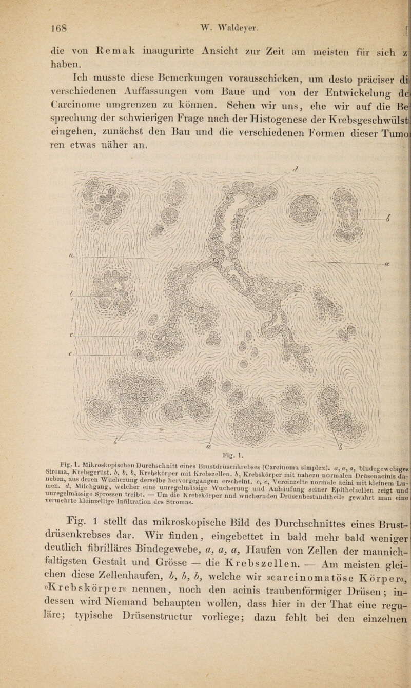 die von Remak inaugurirte Ansicht zur Zeit am meisten für sich z haben. Ich musste diese Bemerkungen vorausschicken, um desto präciser di verschiedenen Auffassungen vom Baue und von der Entwickelung de Carcinome umgrenzen zu können. Sehen wir uns, ehe wir auf die Be sprechung der schwierigen Frage nach der Histogenese der Krebsgeschwulst: eingehen, zunächst den Bau und die verschiedenen Formen dieser Tumo ren etwas näher an, lig. 1. Mikroskopischen Durchschnitt eines Brustdrüsenkrebses (Carcinoma simplex). a, a, a, bindegewebiges ncbena,a,K?§erw' 1’ Krebskörper mit Krebszellen, b, Krebskörper mit nahezu normalen Drüsenacinis da- npn h xri len Wuchet™Z derselbe hervorgegangen erscheint, c, c, Vereinzelte normale acini mit kleinem Lu¬ men. Milchgang, welcher eine unregelmässige Wucherung und Anhäufung seiner Epithelzellen zei°t und unregeimassige Sprossen treibt - Um die Krebskörper und wuchernden Drüsenbestandtheile gewahrt ma°n eine vermehrte kleinzellige Infiltration des Stromas. b Fig. 1 stellt das mikroskopische Bild des Durchschnittes eines Brust¬ drusenkrebses dar. Wir finden, eingebettet in bald mehr bald weniger deutlich fibrilläres Bindegewebe, a, a, a, Haufen von Zellen der mannich- faltigsten Gestalt und Grösse — die Krebszellen. -— Am meisten glei¬ chen diese Zellenhaufen, b, b, b, welche wir »carcinomatose Körper«, »Krebs kör per« nennen, noch den acinis traubenförmiger Drüsen; in¬ dessen wird Niemand behaupten wollen, dass hier in der That eine regu- läre; typische Drüsenstructur vorliege; dazu fehlt bei den einzelnen