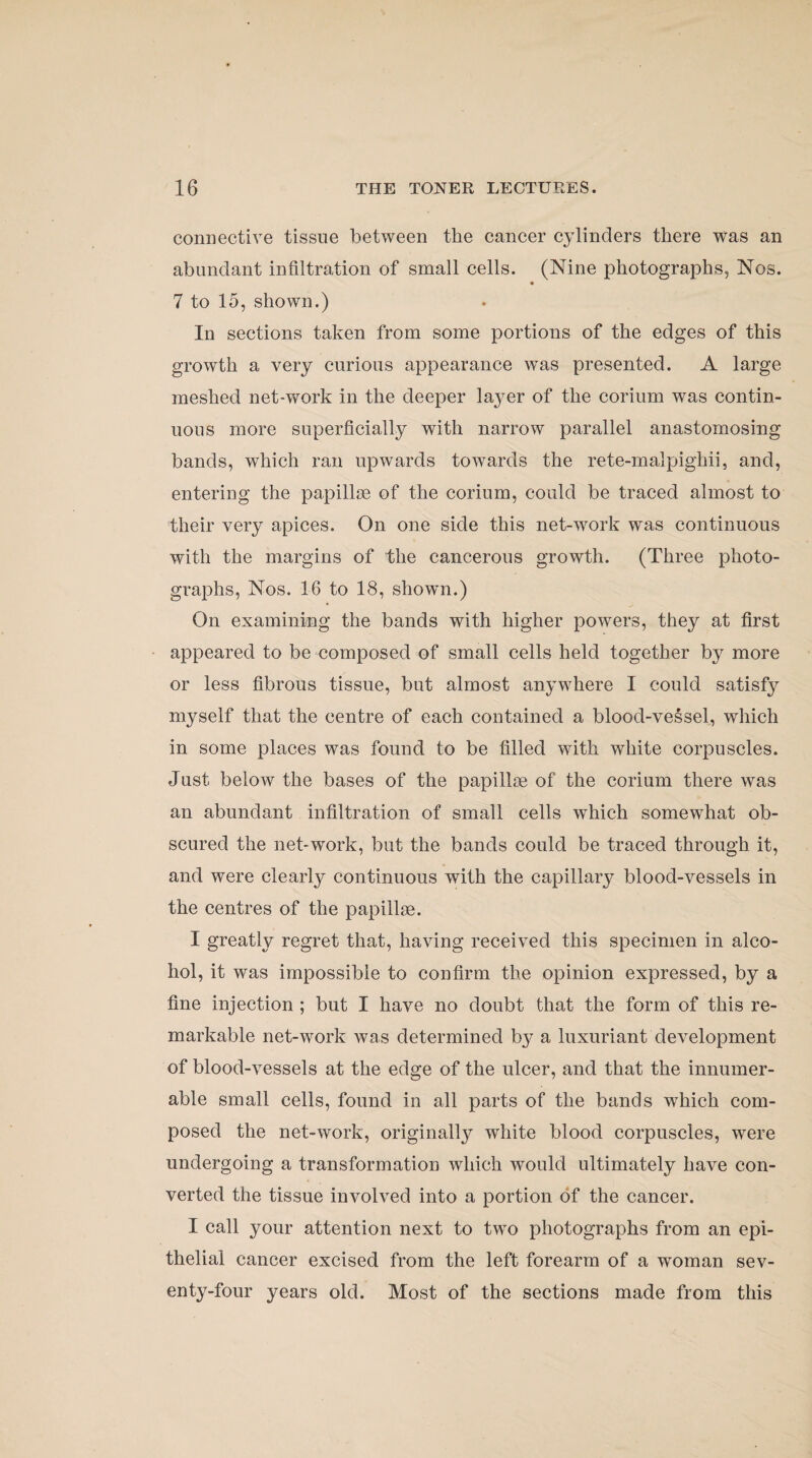 connective tissue between the cancer cylinders there was an abundant infiltration of small cells. (Nine photographs, Nos. « 7 to 15, shown.) In sections taken from some portions of the edges of this growth a very curious appearance was presented. A large meshed net-work in the deeper lajmr of the corium was contin¬ uous more superficially with narrow parallel anastomosing bands, which ran upwards towards the rete-malpighii, and, entering the papillae of the corium, could be traced almost to their very apices. On one side this net-work was continuous with the margins of the cancerous growth. (Three photo¬ graphs, Nos. 16 to 18, shown.) On examining the bands with higher powers, they at first appeared to be composed of small cells held together by more or less fibrous tissue, but almost anywhere I could satisf}^ myself that the centre of each contained a blood-vessel, which in some places was found to be filled with white corpuscles. Just below the bases of the papillae of the corium there was an abundant infiltration of small cells which somewhat ob¬ scured the net-work, but the bands could be traced through it, and were clearly continuous with the capillary blood-vessels in the centres of the papillae. I greatly regret that, having received this specimen in alco¬ hol, it was impossible to confirm the opinion expressed, by a fine injection ; but I have no doubt that the form of this re¬ markable net-work was determined by a luxuriant development of blood-vessels at the edge of the ulcer, and that the innumer¬ able small cells, found in all parts of the bands which com¬ posed the net-work, originally white blood corpuscles, were undergoing a transformation which would ultimately have con¬ verted the tissue involved into a portion of the cancer. I call your attention next to two photographs from an epi¬ thelial cancer excised from the left forearm of a woman sev¬ enty-four years old. Most of the sections made from this