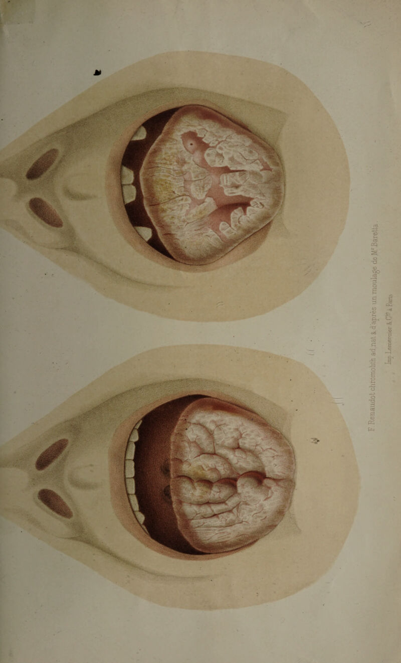 F. Renaudot chromolith. adjialt d'après un moulage deJOaretta. Imp Lemercier & C1- à Pans