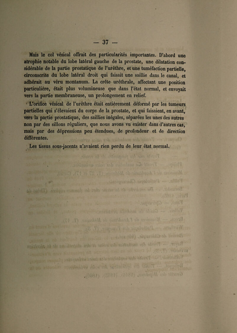 Mais le col vésical offrait des particularités importantes. D’abord une atrophie notable du lobe latéral gauche de la prostate, une dilatation con¬ sidérable de la partie prostatique de l’urèthre, et une tuméfaction partielle, circonscrite dü lobe latéral droit qui faisait une saillie dans le canal, et adhérait au véru montanum. La crête uréthrale, affectant une position particulière, était plus volumineuse que dans l’état normal, et envoyait vers la partie membraneuse, un prolongement en relief. L’orifice vésical de l’urèthre était entièrement déformé par les tumeurs partielles qui s’élevaient du corps de la prostate, et qui faisaient, en avant, vers la partie prostatique, des saillies inégales, séparées les unes des autres » non par des sillons réguliers, que nous avons vu exister dans d’autres cas, mais par des dépressions peu étendues, de profondeur et de direction différentes. Les tissus sous-jacents n’avaient rien perdu de leur état normal.