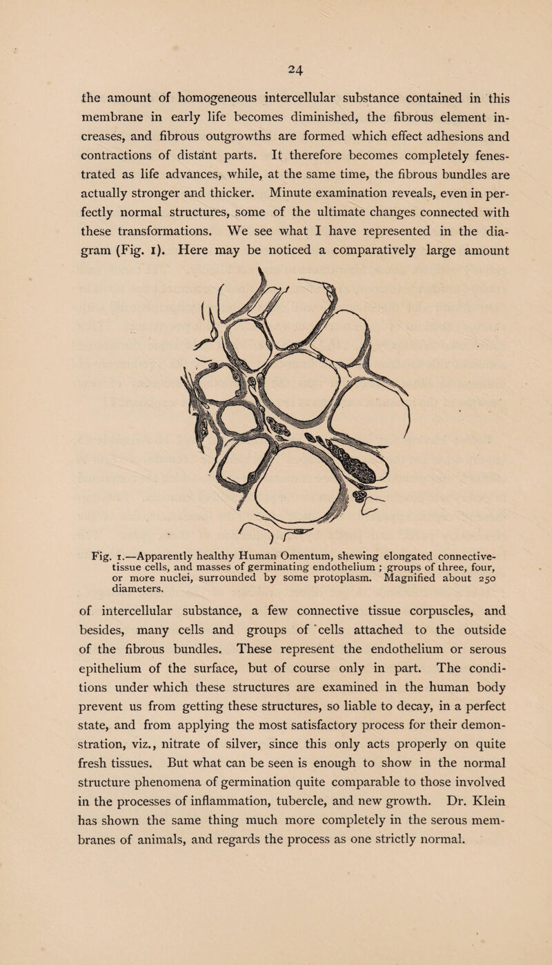 the amount of homogeneous intercellular substance contained in this membrane in early life becomes diminished, the fibrous element in¬ creases, and fibrous outgrowths are formed which effect adhesions and contractions of distant parts. It therefore becomes completely fenes¬ trated as life advances, while, at the same time, the fibrous bundles are actually stronger and thicker. Minute examination reveals, even in per¬ fectly normal structures, some of the ultimate changes connected with these transformations. We see what I have represented in the dia¬ gram (Fig. i). Here may be noticed a comparatively large amount Fig. i.—Apparently healthy Human Omentum, shewing elongated connective- tissue cells, and masses of germinating endothelium ; groups of three, four, or more nuclei, surrounded by some protoplasm. Magnified about 250 diameters. of intercellular substance, a few connective tissue corpuscles, and besides, many cells and groups of cells attached to the outside of the fibrous bundles. These represent the endothelium or serous epithelium of the surface, but of course only in part. The condi¬ tions under which these structures are examined in the human body prevent us from getting these structures, so liable to decay, in a perfect state, and from applying the most satisfactory process for their demon¬ stration, viz., nitrate of silver, since this only acts properly on quite fresh tissues. But what can be seen is enough to show in the normal structure phenomena of germination quite comparable to those involved in the processes of inflammation, tubercle, and new growth. Dr. Klein has shown the same thing much more completely in the serous mem¬ branes of animals, and regards the process as one strictly normal.