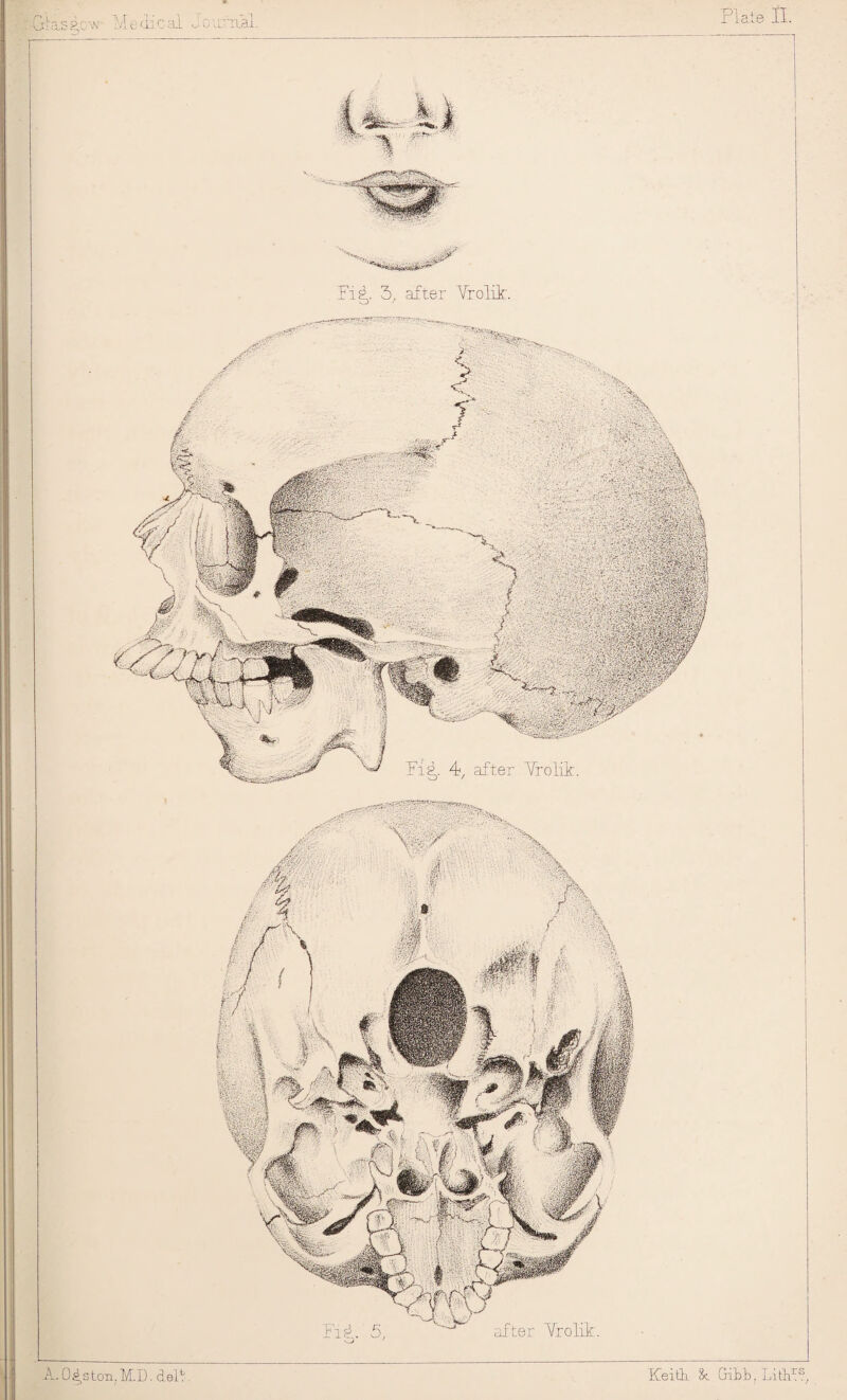 .04,stoii,M.D.del^ Keit}i 8<. Gibb, Lith^^, 1S2,CW cai 'iiai. Pi^. 5, after Yrolit. after Yrolik. Pi^. 4, after Yrolik.