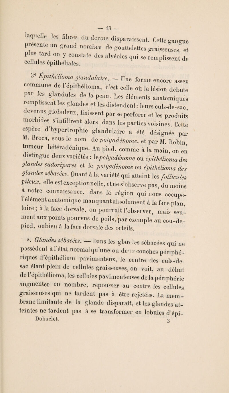 laquelle les fibres du derme disparaissent. Cette gangue présente un grand nombre de gouttelettes graisseuses et plus tard on y constate des alvéoles qui se remplissent de cellules epithéliales. 3° EPtt/Æ°ma glandulaire, — Une forme encore assez commune de l’épithélioma, c’est celle où la lésion débute par les glandules de la peau. Les éléments anatomiques remplissent les glandes et les distendent; leurs culs-de-sac devenus globuleux, finissent par se perforer et les produits morbides s’infiltrent alors dans les parties voisines. Cette espece d’hypertrophie glandulaire a été désignée par M. Broca, sous le nom de polyadénome, et par M. Robin tumeur hétéradénique. Au pied, comme à la main, on en c istingue deux variétés : lepolyadénome ou épithélioma des glandes sudoripares et le polyadénome ou épithélioma des glandes sébacées. Quant à la variété qui atteint les follicules pileux, elle est exceptionnelle,etne s’observe pas, du moins à notre connaissance, dans la région qui nous occupe- l’élément anatomique manquant absolument à la face plan, taire ; à la face dorsale, on pourrait l’observer, mais seu- ment aux points pourvus de poils, par exemple au cou-de- pied, oubien à la face dorsale des orteils. a* Glandes sébacées. — Dans les glandes sébacées qui ne possèdent à l’état normalqu’une ou denx couches périphé¬ riques d’épithélium pavimenteux, le centre des culs-de- sac étant plein de cellules graisseuses, on voit, au début de 1 épithélioma, les cellules pavimenteuses de la périphérie augmenter en nombre, repousser au centre les cellules graisseuses qui ne tardent pas à être rejetées. La mem ¬ brane limitante de la glande disparaît, et les glandes at¬ teintes ne tardent pas à se transformer en lobules d’épi- Dubuclet. 0