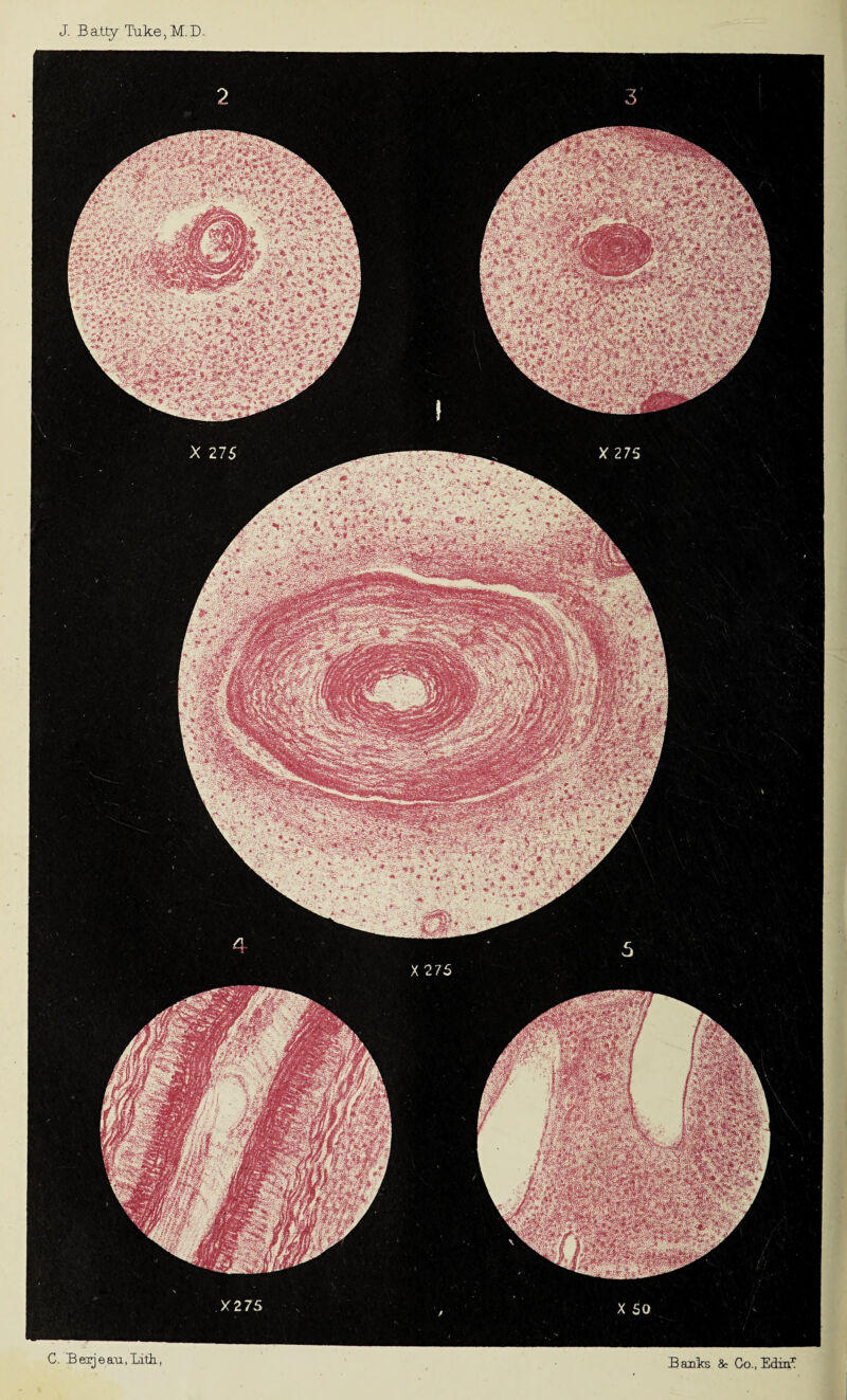 J. B atty Take, M. D. :• ': .^k * dfiW/*: >, >v.-.fc?r igj| X 275 C. Bexjea-u., Lith., Baulks & Go., Edin^