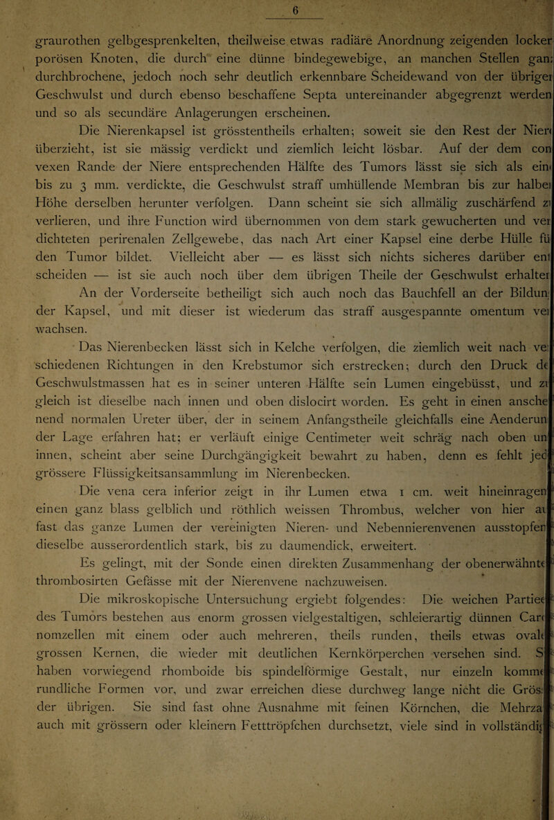 graurothen gelbgesprenkelten, theilweise etwas radiäre Anordnung zeigenden locker! porösen Knoten, die durch eine dünne bindegewebige, an manchen Stellen gan; durchbrochene, jedoch noch sehr deutlich erkennbare Scheidewand von der übriger Geschwulst und durch ebenso beschaffene Septa untereinander abgegrenzt werden und so als secundäre Anlagerungen erscheinen. Die Nierenkapsel ist grösstentheils erhalten; soweit sie den Rest der Niere überzieht, ist sie massig verdickt und ziemlich leicht lösbar. Auf der dem con vexen Rande der Niere entsprechenden Hälfte des Tumors lässt sie sich als ein» bis zu 3 mm. verdickte, die Geschwulst straff umhüllende Membran bis zur halbei Höhe derselben herunter verfolgen. Dann scheint sie sich allmälig zuschärfend zi verlieren, und ihre Function wird übernommen von dem stark gewucherten und ver dichteten perirenalen Zellgewebe, das nach Art einer Kapsel eine derbe Hülle fü den Tumor bildet. Vielleicht aber — es lässt sich nichts sicheres darüber ent scheiden — ist sie auch noch über dem übrigen Theile der Geschwulst erhalter An der Vorderseite betheiligt sich auch noch das Bauchfell an der Bildun der Kapsel, und mit dieser ist wiederum das straff ausgespannte omentum ve wachsen. Das Nierenbecken lässt sich in Kelche verfolgen, die ziemlich weit nach ve schiedenen Richtungen in den Krebstumor sich erstrecken; durch den Druck de Geschwulstmassen hat es in seiner unteren Hälfte sein Lumen eingebüsst, und zi gleich ist dieselbe nach innen und oben dislocirt worden. Es geht in einen ansche nend normalen Ureter über, der in seinem Anfangs theile gleichfalls eine Aenderun der Lage erfahren hat; er verläuft einige Centimeter weit schräg nach oben un innen, scheint aber seine Durchgängigkeit bewahrt zu haben, denn es fehlt jed grössere Flüssigkeitsansammlung im Nierenbecken. Die vena cera inferior zeigt in ihr Lumen etwa i cm. weit hineinragen einen ganz blass gelblich und röthlich weissen Thrombus, welcher von hier ai fast das ganze Lumen der vereinigten Nieren- und Nebennierenvenen ausstopfen dieselbe ausserordentlich stark, bis zu daumendick, erweitert. Es gelingt, mit der Sonde einen direkten Zusammenhang der obenerwähnte thrombosirten Gefässe mit der Nierenvene nachzuweisen. Die mikroskopische Untersuchung ergiebt folgendes: Die weichen Partien des Tumors bestehen aus enorm grossen vielgestaltigen, schleierartig dünnen Can nomzellen mit einem oder auch mehreren, theils runden, theils etwas ovak grossen Kernen, die wieder mit deutlichen Kernkörperchen versehen sind. S haben vorwiegend rhomboide bis spindelförmige Gestalt, nur einzeln komme rundliche Formen vor, und zwar erreichen diese durchweg lange nicht die Gros: der übrigen. Sie sind fast ohne Ausnahme mit feinen Körnchen, die Mehrza auch mit grossem oder kleinern Fetttröpfchen durchsetzt, viele sind in vollständig