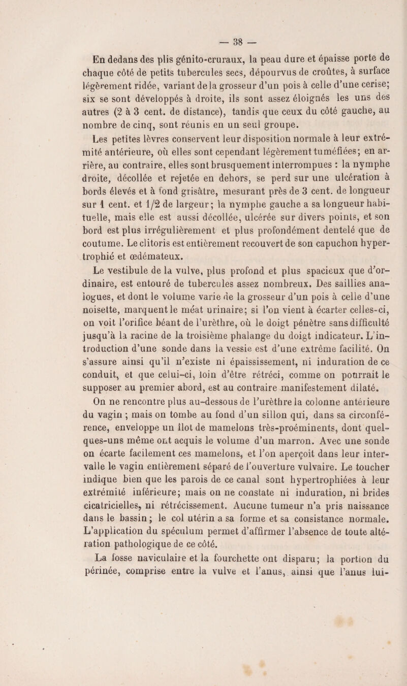En dedans des plis génito-cruraux, la peau dure et épaisse porte de chaque côté de petits tubercules secs, dépourvus de croûtes, à surface légèrement ridée, variant de la grosseur d’un pois à celle d’une cerise; six se sont développés à droite, ils sont assez éloignés les uns des autres (2 à 3 cent, de distance), tandis que ceux du côté gauche, au nombre de cinq, sont réunis en un seul groupe. Les petites lèvres conservent leur disposition normale à leur extré¬ mité antérieure, où elles sont cependant légèrement tu méfiées; en ar¬ rière, au contraire, elles sont brusquement interrompues : la nymphe droite, décollée et rejetée en dehors, se perd sur une ulcération à bords élevés et à fond grisâtre, mesurant près de 3 cent, de longueur sur 1 cent, et 1/2 de largeur; la nymphe gauche a sa longueur habi¬ tuelle, mais elle est aussi décollée, ulcérée sur divers points, et son bord est plus irrégulièrement et plus profondément dentelé que de coutume. Le clitoris est entièrement recouvert de son capuchon hyper¬ trophié et oedémateux. Le vestibule de la vulve, plus profond et plus spacieux que d’or¬ dinaire, est entouré de tubercules assez nombreux. Des saillies ana¬ logues, et dont le volume varie de la grosseur d’un pois à celle d’une noisette, marquent le méat urinaire; si Ton vient à écarter celles-ci, on voit l’orifice béant de l’urèthre, où le doigt pénètre sans difficulté jusqu’à la racine de la troisième phalange du doigt indicateur. L'in¬ troduction d’une sonde dans la vessie est d’une extrême facilité. On s’assure ainsi qu’il n’existe ni épaississement, ni induration de ce conduit, et que celui-ci, loin d’être rétréci, comme on pourrait le supposer au premier abord, est au contraire manifestement dilaté. On ne rencontre plus au-dessous de l’urèthre la colonne antéiieure du vagin ; mais on tombe au fond d’un sillon qui, dans sa circonfé¬ rence, enveloppe un îlot de mamelons très-proéminents, dont quel¬ ques-uns même ont acquis le volume d’un marron. Avec une sonde on écarte facilement ces mamelons, et l’on aperçoit dans leur inter¬ valle le vagin entièrement séparé de l’ouverture vulvaire. Le toucher indique bien que les parois de ce canal sont hypertrophiées à leur extrémité inférieure; mais on ne constate ni induration, ni brides cicatricielles, ni rétrécissement. Aucune tumeur n’a pris naissance dans le bassin ; le col utérin a sa forme et sa consistance normale. L’application du spéculum permet d’affirmer l’absence de toute alté¬ ration pathologique de ce côté. La fosse naviculaire et la fourchette ont disparu; la portion du périnée, comprise entre la vulve et l’anus, ainsi que l’anus lui-