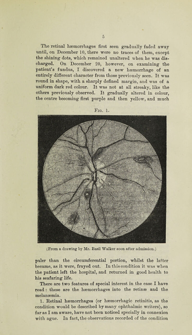 The retinal haemorrhages first seen gradually faded away until, on December 10, there were no traces of them, except the shining dots, which remained unaltered when he was dis¬ charged. On December 20, however, on examining the patient’s fundus, I discovered a new haemorrhage of an entirely different character from those previously seen. It was round in shape, with a sharply defined margin, and was of a uniform dark red colour. It was not at all streaky, like the others previously observed. It gradually altered in colour, the centre becoming first purple and then yellow, and much Fig. 1. (From a drawing by Mr. Basil Walker soon after admission.) paler than the circumferential portion, whilst the latter became, as it were, frayed out. In this condition it was when the patient left the hospital, and returned in good health to his seafaring life. There are two features of special interest in the case I have read : these are the haemorrhages into the retinae and the melanaemia. 1. Retinal haemorrhages (or haemorrhagic retinitis, as the condition would be described by many ophthalmic writers), so far as I am aware, have not been noticed specially in connexion with ague. In fact, the observations recorded of the condition