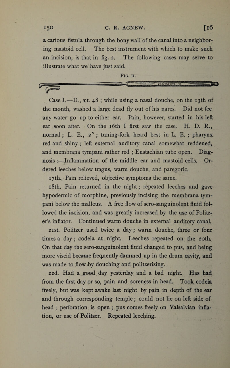 a carious fistula through the bony wall of the canal into a neighbor¬ ing mastoid cell. The best instrument with which to make such an incision, is that in fig. 2. The following cases may serve to illustrate what we have just said. Fig. 11. Case I.—D., act. 48 ; while using a nasal douche, on the 13th of the month, washed a large dead fly out of his nares. Did not fee any water go up to either ear. Pain, however, started in his left ear soon after. On the 16th I first saw the case. H. D. R., normal; L. E., 2; tuning-fork heard best in L. E. ; pharynx red and shiny ; left external auditory canal somewhat reddened, and membrana tympani rather red ; Eustachian tube open. Diag¬ nosis :—-Inflammation of the middle ear and mastoid cells. Or¬ dered leeches below tragus, warm douche, and paregoric. 17th. Pain relieved, objective symptoms the same. 18th. Pain returned in the night; repeated leeches and gave hypodermic of morphine, previously incising the membrana tym¬ pani below the malleus. A free flow of sero-sanguinolent fluid fol¬ lowed the incision, and was greatly increased by the use of Politz- er’s inflator. Continued warm douche in external auditory canal. 21 st. Politzer used twice a day; warm douche, three or four times a day; codeia at night. Leeches repeated on the 20th. On that day the sero-sanguinolent fluid changed to pus, and being more viscid became frequently dammed up in the drum cavity, and was made to flow by douching and politzerizing. 2 2d. Had a. good day yesterday and a bad night. Has had from the first day or so, pain and soreness in head. Took codeia freely, but was kept awake last night by pain in depth of the ear and through corresponding temple; could not lie on left side of head ; perforation is open; pus comes freely on Valsalvian infla¬ tion, or use of Politzer. Repeated leeching.