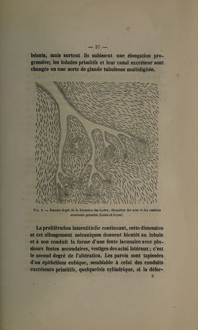 béants, mais surtout ils subissent une élongation pro¬ gressive; les lobules primitifs et leur canal excréteur sont changés en une sorte de glande tubuleuse multidigitée. Fig. 9. Premier degré de la formation des kystes ; élongation des acini et des conduits excréteurs primitifs (Labbé et Coyne). La prolifération interstitielle continuant, cette distension et cet allongement mécaniques donnent bientôt au lobule et à son conduit la forme d’une fente lacunaire avec plu¬ sieurs fentes secondaires, vestiges des acini latéraux; c’est le second degré de l’altération. Les parois sont tapissées d’un épithélium cubique, semblable à celui des conduits excréteurs primitifs, quelquefois cylindrique, si la défor- 8 i