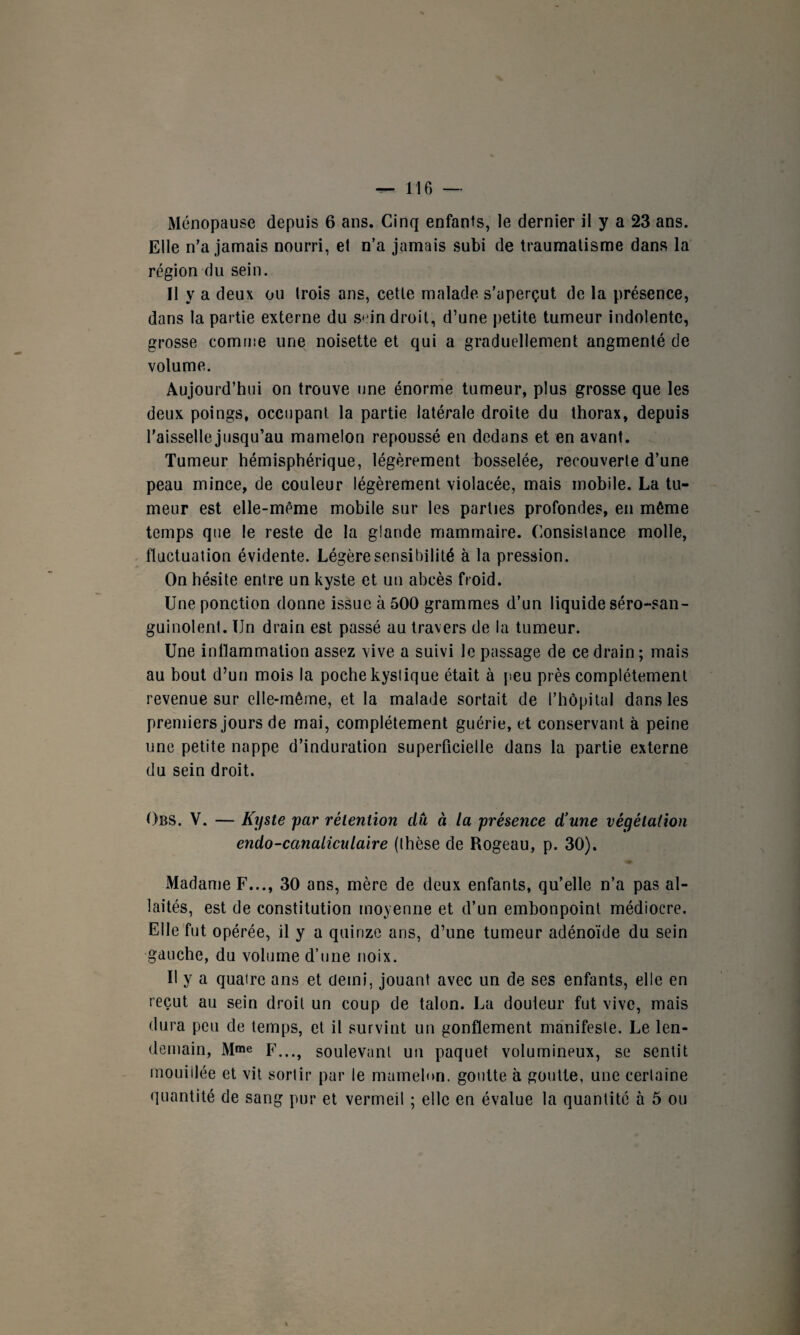 Ménopause depuis 6 ans. Cinq enfants, le dernier il y a 23 ans. Elle n’a jamais nourri, el n’a jamais subi de traumatisme dans la région du sein. Il y a deux ou trois ans, cette malade s’aperçut de la présence, dans la partie externe du sein droit, d’une petite tumeur indolente, grosse comme une noisette et qui a graduellement angmenté de volume. Aujourd’hui on trouve une énorme tumeur, plus grosse que les deux poings, occupant la partie latérale droite du thorax, depuis l'aisselle jusqu’au mamelon repoussé en dedans et en avant. Tumeur hémisphérique, légèrement bosselée, recouverte d’une peau mince, de couleur légèrement violacée, mais mobile. La tu¬ meur est elle-même mobile sur les parties profondes, en même temps que le reste de la glande mammaire. Consistance molle, fluctuation évidente. Légère sensibilité à la pression. On hésite entre un kyste et un abcès froid. Une ponction donne issue à 500 grammes d’un liquide séro-san- guinolent. Un drain est passé au travers de la tumeur. Une inflammation assez vive a suivi le passage de ce drain ; mais au bout d’un mois la poche kystique était à peu près complètement revenue sur elle-même, et la malade sortait de l’hôpital dans les premiers jours de mai, complètement guérie, et conservant à peine une petite nappe d’induration superficielle dans la partie externe du sein droit. Obs. V. — Kyste par rétention dû à la présence d'une végétation endo-canaliculaire (thèse de Rogeau, p. 30). Madame F..., 30 ans, mère de deux enfants, qu’elle n’a pas al¬ laités, est de constitution moyenne et d’un embonpoint médiocre. Elle fut opérée, il y a quinze ans, d’une tumeur adénoïde du sein gauche, du volume d’une noix. Il y a quaire ans et demi, jouant avec un de ses enfants, elle en reçut au sein droit un coup de talon. La douteur fut vive, mais dura peu de temps, et il survint un gonflement manifeste. Le len¬ demain, Mme E..., soulevant un paquet volumineux, se sentit mouillée et vit sortir par le mamelon, goutte à goutte, une certaine quantité de sang pur et vermeil ; elle en évalue la quantité à 5 ou