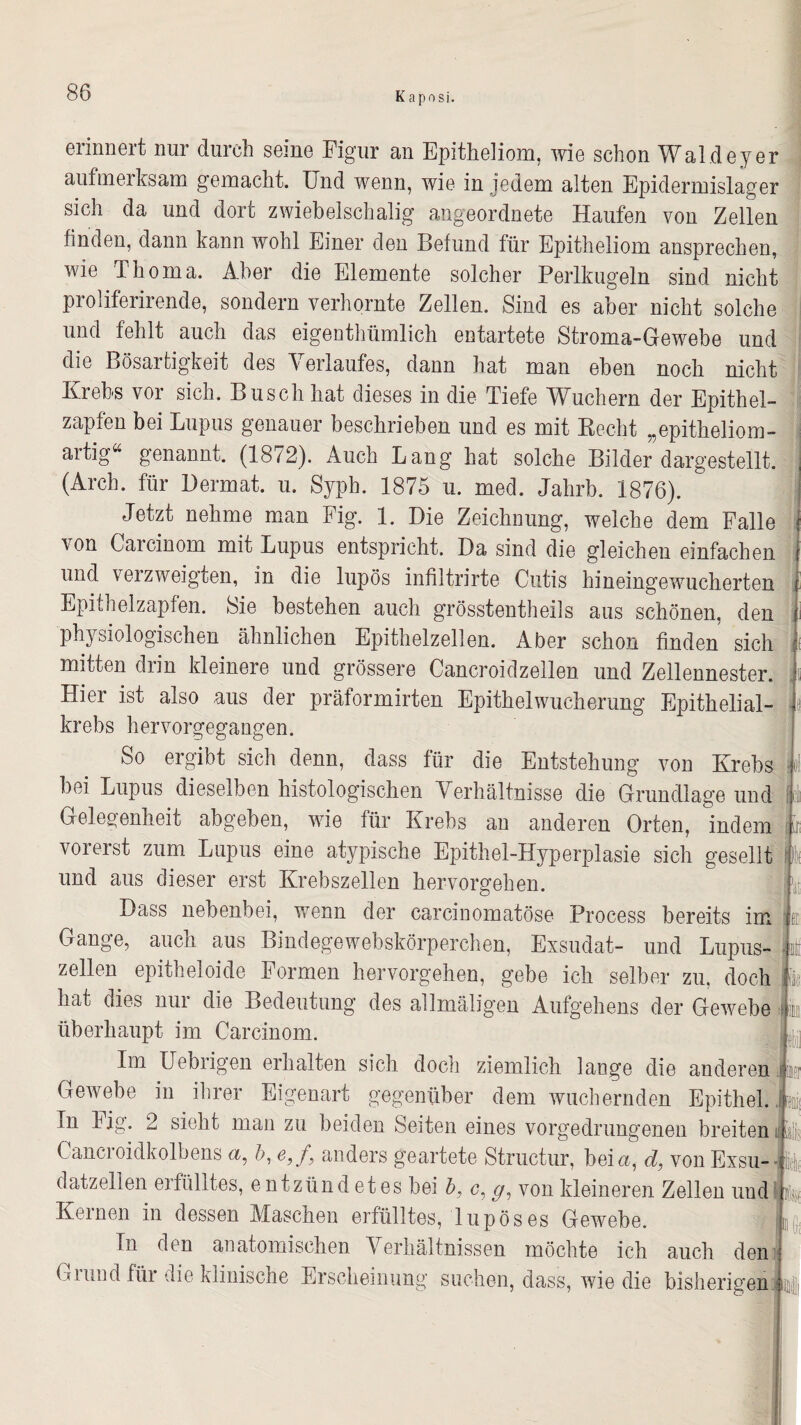 erinnert nur durch seine Figur an Epitheliom, wie schon Waldeyer aufmerksam gemacht. Und wenn, wie in jedem alten Epidermislager sich da und dort zwiebelschalig angeordnete Haufen von Zellen finden, dann kann wohl Einer den Befund für Epitheliom ansprechen, wie Thoma. Aber die Elemente solcher Perlkugeln sind nicht proliferirende, sondern verhornte Zellen. Sind es aber nicht solche und fehlt auch das eigenthümlich entartete Stroma-Gewebe und die Bösartigkeit des Verlaufes, dann hat man eben noch nicht Krebs vor sich. Busch hat dieses in die Tiefe Wuchern der Epithel¬ zapfen bei Lupus genauer beschrieben und es mit Recht „epitheliom¬ artig« genannt. (1872). Auch Lang hat solche Bilder dargestellt. (Arch. für Dermat. u. Syph. 1875 u. med. Jahrb. 1876). Jetzt nehme man Fig. 1. Die Zeichnung, welche dem Falle von Careinom mit Lupus entspricht. Da sind die gleichen einfachen und verzweigten, in die lupös infiltrirte Cutis hineingewucherten Epithelzapfen. Sie bestehen auch grösstentheils aus schönen, den physiologischen ähnlichen Epithelzellen. Aber schon finden sich mitten drin kleinere und grössere Cancroidzellen und Zellennester. Hier ist also aus der präformirten Epithelwucherung Epithelial¬ krebs hervorgegangen. So ergibt sich denn, dass für die Entstehung von Krebs bei Lupus dieselben histologischen Verhältnisse die Grundlage und Gelegenheit abgeben, wie für Krebs an anderen Orten, indem voierst zum Lupus eine atypische Epithel-Hyperplasie sich gesellt und aus dieser erst Krebszellen hervorgehen. Dass nebenbei, wenn der carcinomatöse Process bereits im Gange, auch aus Bindegewebskörperchen, Exsudat- und Lupus¬ zellen epitheloide Formen hervorgehen, gebe ich selber zu, doch hat dies nur die Bedeutung des allmäligen Aufgehens der Gewebe überhaupt im Carcinom. Im Fiebrigen erhalten sich doch ziemlich lange die anderen Gewebe in ihrer Eigenart gegenüber dem wuchernden Epithel. In lig. 2 sieht man zu beiden Seiten eines vorgedrungenen breiten Cancroidkolbens a, b, e,f} anders geartete Structur, beia, d, von Exsu¬ datzellen erfülltes, entzünd et es bei b, o, g, von kleineren Zellen und Kernen in dessen Maschen erfülltes, lupös es Gewebe. In den anatomischen Verhältnissen möchte ich auch den Ornnd für die klinische Erscheinung suchen, dass, wie die bisherigen