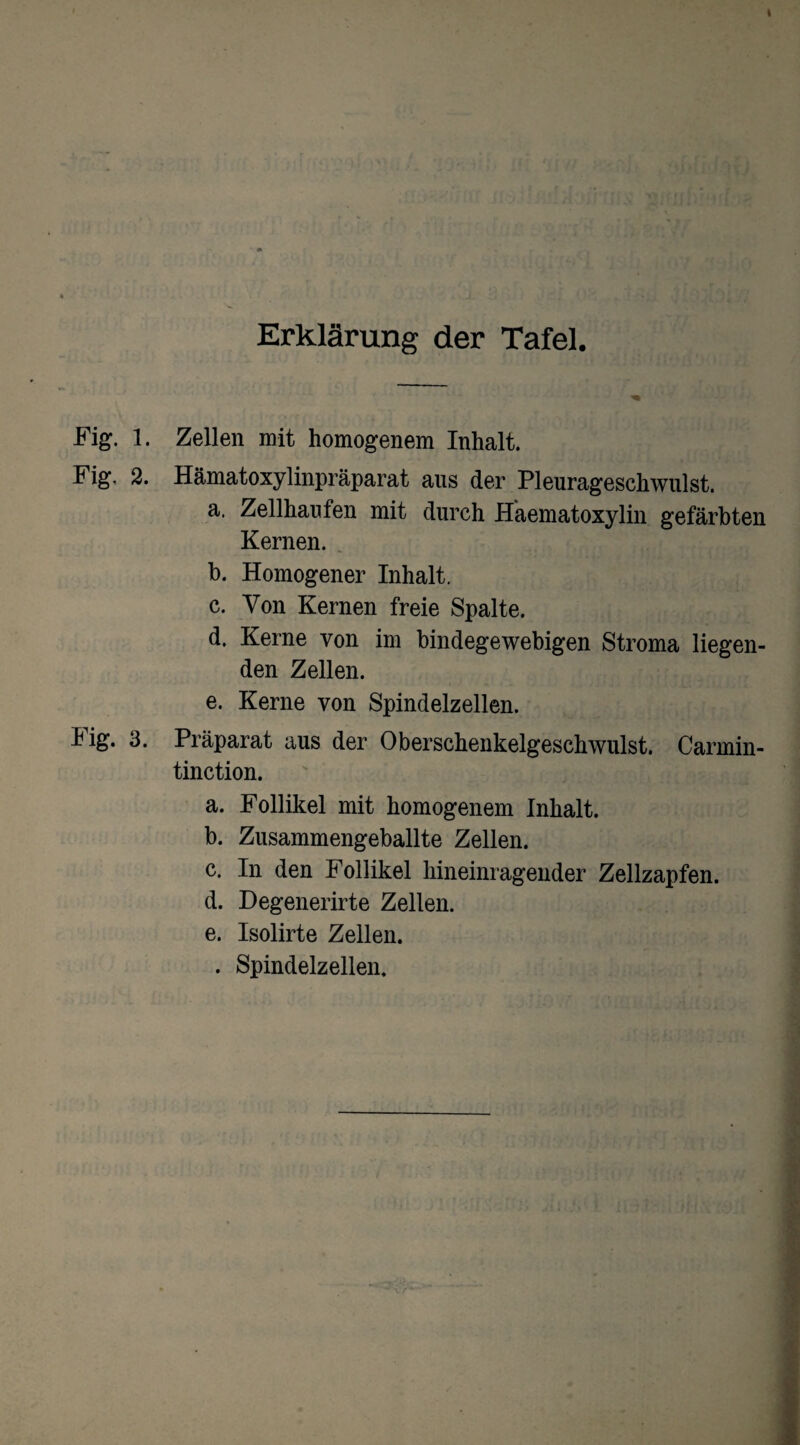 Erklärung der Tafel. Fig. 1. Zellen mit homogenem Inhalt. Fig, 2. Hämatoxylinpräparat aus der Pleurageschwulst. a. Zellhaufen mit durch Haematoxylin gefärbten Kernen. b. Homogener Inhalt. c. Von Kernen freie Spalte. d. Kerne von im bindegewebigen Stroma liegen¬ den Zellen. e. Kerne von Spindelzellen. hig. 3. Präparat aus der Oberschenkelgeschwulst. Carrnin- tinction. a. Follikel mit homogenem Inhalt. b. Zusammengeballte Zellen. c. In den Follikel hineinragender Zellzapfen. d. Degenerirte Zellen. e. Isolirte Zellen. . Spindelzellen.