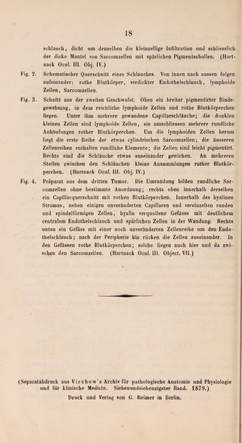 schlauch, dicht um denselben die kleinzellige Infiltration und schliesslich der dicke Mantel von Sareomzellen mit spärlichen Pigmentschollen. (Hart¬ nack Ocul. III. Obj. IV.) Fig. 2. Schematischer Querschnitt eines Schlauches. Von innen nach aussen folgen aufeinander: rothe Blutkörper, verdickter Endothelschlauch, lymphoide Zellen, Sareomzellen. Fig. 3. Schnitt aus der zweiten Geschwulst. Oben ein breiter pigmentirter Binde- gewebszug, in dem reichliche lymphoide Zellen und rothe Blutkörperchen liegen. Unter ihm mehrere gewundene Capillarschläuche; die dunklen kleinen Zellen sind lymphoide Zellen, sie umschliessen mehrere rundliche Anhäufungen rother Blutkörperchen. Um die lymphoiden Zellen herum liegt die erste Beihe der etwas cylindrischen Sareomzellen; die äusseren Zellenreihen enthalten rundliche Elemente; die Zellen sind leicht pigmentirt. Rechts sind die Schläuche etwas auseinander gewichen. An mehreren Stellen zwischen den Schläuchen kleine Ansammlungen rother Blutkör¬ perchen. (Hartnack Ocul. III. Obj. IV.) Fig. 4. Präparat aus dem dritten Tumor. Die Umrandung bilden rundliche Sar- comzellen ohne bestimmte Anordnung; rechts oben innerhalb derselben ein Caplllarquerschnitt mit rothen Blutkörperchen. Innerhalb des hyalinen Stromas, neben einigen unveränderten Capillaren und vereinzelten runden und spindelförmigen Zellen, hyalin verquollene Gefässe mit deutlichem centralem Endothelschlauch und spärlichen Zellen in der Wandung. Rechts unten ein Gefäss mit einer noch unveränderten Zellenreihe um den Endo¬ thelschlauch ; nach der Peripherie hin rücken die Zellen auseinander. In den Gefässen rothe Blutkörperchen; solche liegen auch hier und da zwi¬ schen den Sareomzellen. (Hartnack Ocul. III. Object. VII.) (Separatabdruck aus Virchow’s Archiv für pathologische Anatomie und Physiologie und für klinische Medicin. Siebenundsiebenzigster Band. 1879.) Druck und Verlag von G. Reimer in Berlin.
