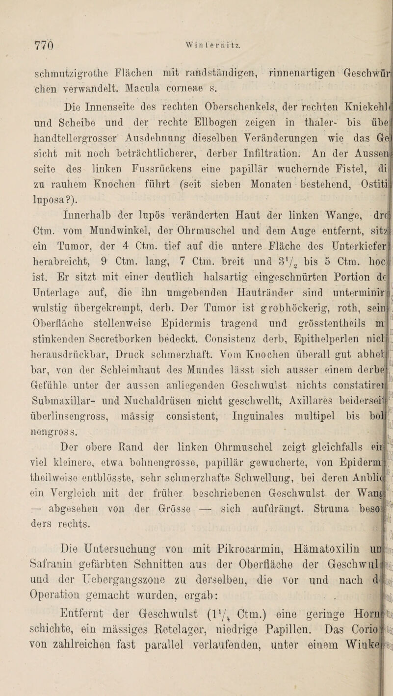 schmutzigrothe Flächen mit randständigen, rinnenartigen Geschwür chen verwandelt. Macula corneae s. Die Innenseite des rechten Oberschenkels, der rechten Kniekehl und Scheibe und der rechte Ellbogen zeigen in thaler- bis übe handtellergrosser Ausdehnung dieselben Veränderungen wie das Gel - sicht mit noch beträchtlicherer, derber Infiltration. An der Aussenf seite des linken Fussriickens eine papillär wuchernde Fistel, di| zu rauhem Knochen führt (seit sieben Monaten bestehend, Ostiti d luposa?). innerhalb der lupös veränderten Haut der linken Wange, draj Ctm. vom Mundwinkel, der Ohrmuschel und dem Auge entfernt, sitz: ein 'Tumor, der 4 Ctm. tief auf die untere Fläche des Unterkiefer herabreicht, 9 Ctm. lang, 7 Ctm. breit und 3V2 bis 5 Ctm. hoc ist. Er sitzt mit einer deutlich hals artig eingeschnürten Portion de Unterlage auf, die ihn umgebenden Hautränder sind unterminir wulstig übergekrempt, derb. Der Tumor ist grobhöckerig, roth, sein Oberfläche stellenweise Epidermis tragend und grösstentheils m stinkenden Secretborken bedeckt. Consistenz derb, Epithelperlen nicl herausdrückbar, Druck schmerzhaft. Vom Knochen überall gut abhet bar, von der Schleimhaut des Mundes lässt sich ausser einem derbe Gefühle unter der aussen anliegenden Geschwulst nichts constatirei Submaxillar- und Kuclialdrüsen nicht geschwellt, Axillares beiderseits überlinsengross, mässig consistent, Inguinales multipel bis bol nengross. Der obere Fand der linken Ohrmuschel zeigt gleichfalls ein viel kleinere, etwa bohnongrosse, papillär gewucherte, von Epiderm: theilweise entblösste, sehr schmerzhafte Schwellung, bei deren Anbli( I L ein Vergleich mit der früher beschriebenen Geschwulst der Wan^ — abgesehen von der Grösse — sich aufdrängt. Struma beso: ders rechts. ifitjj Die Untersuchung von mit Pikrocarmin, Hämatoxilin ud Safranin gefärbten Schnitten aus der Oberfläche der Geschwul und der Uebergangszone zu derselben, die vor und nach d<{ ; Operation gemacht wurden, ergab: . Entfernt der Geschwulst (U/4 Ctm.) eine geringe Horn schichte, ein massiges Retelager, niedrige Papillen. Das Corioj|lii von zahlreichen fast parallel verlaufenden, unter einem Winke