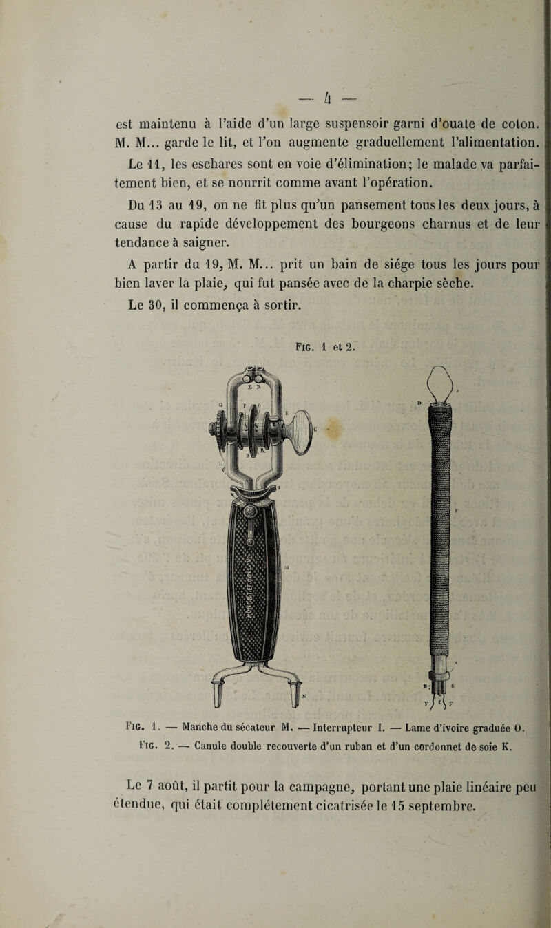 - /I - est maintenu à l’aide d’un large suspensoir garni d’ouate de colon. M. M... garde le lit, et l'on augmente graduellement l’alimentation. Le 11, les eschares sont en voie d’élimination; le malade va parfai¬ tement bien, et se nourrit comme avant l’opération. Du 13 au 19, on ne fit plus qu'un pansement tous les deux jours, à cause du rapide développement des bourgeons charnus et de leur tendance à saigner. A partir du 19, M. M... prit un bain de siège tous les jours pour bien laver la plaie, qui fut pansée avec de la charpie sèche. Le 30, il commença à sortir. Fig. 1 et 2. Le 7 août, il partit pour la campagne, portant une plaie linéaire peu étendue, qui était complètement cicatrisée le 15 septembre.