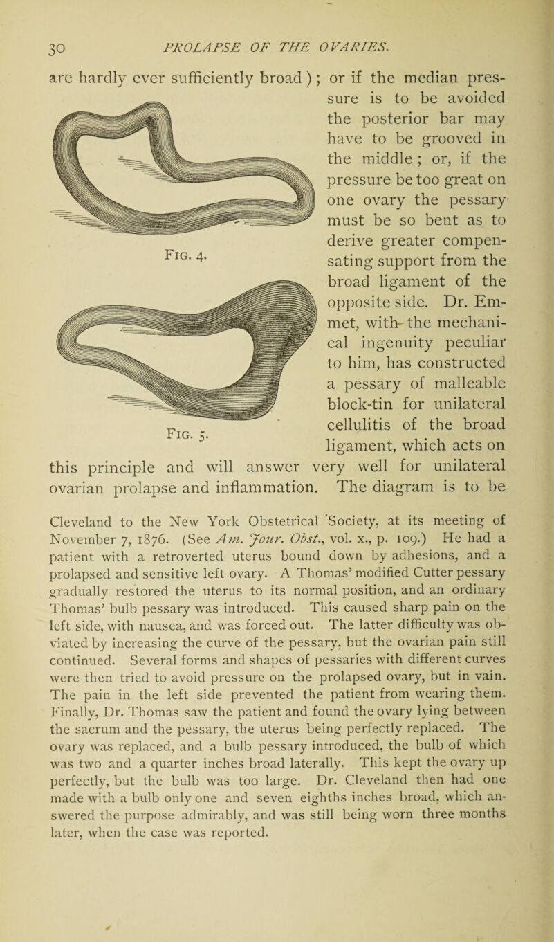 or if the median pres¬ sure is to be avoided the posterior bar may have to be grooved in the middle ; or, if the pressure be too great on one ovary the pessary must be so bent as to derive greater compen¬ sating support from the broad ligament of the opposite side. Dr. Em¬ met, with-the mechani¬ cal ingenuity peculiar to him, has constructed a pessary of malleable block-tin for unilateral cellulitis of the broad ligament, which acts on this principle and will answer very well for unilateral ovarian prolapse and inflammation. The diagram is to be Cleveland to the New York Obstetrical 'Society, at its meeting of November 7, 1876. (See Am. Jour. Obst., vol. x., p. 109.) He had a patient with a retroverted uterus bound down by adhesions, and a prolapsed and sensitive left ovary. A Thomas’ modified Cutter pessary gradually restored the uterus to its normal position, and an ordinary Thomas’ bulb pessary was introduced. This caused sharp pain on the left side, with nausea, and was forced out. The latter difficulty was ob¬ viated by increasing the curve of the pessary, but the ovarian pain still continued. Several forms and shapes of pessaries with different curves were then tried to avoid pressure on the prolapsed ovary, but in vain. The pain in the left side prevented the patient from wearing them. Finally, Dr. Thomas saw the patient and found the ovary lying between the sacrum and the pessary, the uterus being perfectly replaced. The ovary was replaced, and a bulb pessary introduced, the bulb of which was two and a quarter inches broad laterally. This kept the ovary up perfectly, but the bulb was too large. Dr. Cleveland then had one made with a bulb only one and seven eighths inches broad, which an¬ swered the purpose admirably, and was still being worn three months later, when the case was reported. are hardly ever sufficiently broad); Fig. 4. Fig. 5.