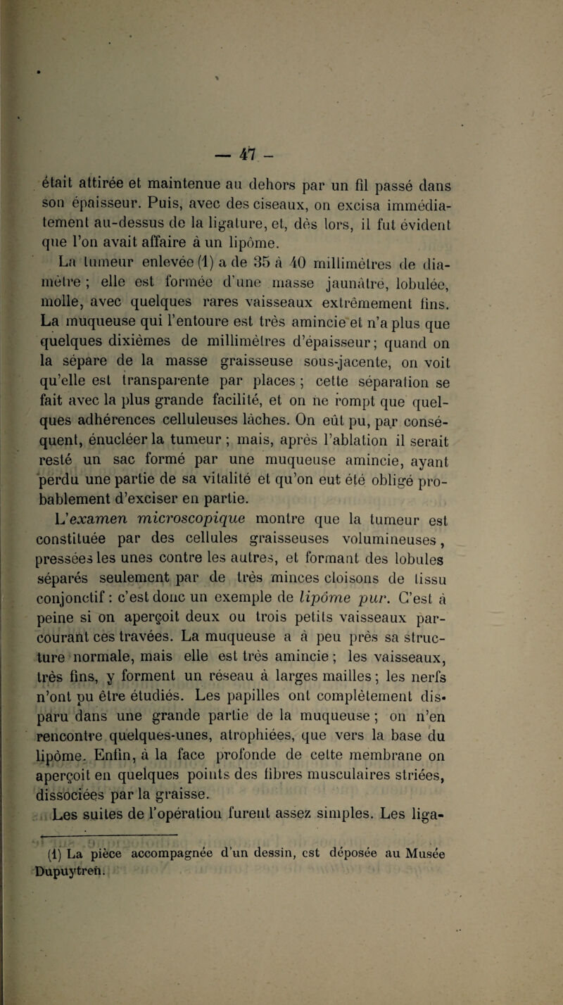 était attirée et maintenue au dehors par un fil passé dans son épaisseur. Puis, avec des ciseaux, on excisa immédia¬ tement au-dessus de la ligature, et, dès lors, il fut évident que l’on avait affaire à un lipome. La tumeur enlevée (1) a de 35 à 40 millimètres de dia¬ mètre ; elle est formée d’une masse jaunâtre, lobulée, molle, avec quelques rares vaisseaux extrêmement fins. La muqueuse qui l’entoure est très amincie et n’a plus que quelques dixièmes de millimètres d’épaisseur; quand on la sépare de la masse graisseuse sous-jacente, on voit qu’elle est transparente par places ; cette séparation se fait avec la plus grande facilité, et on ne rompt que quel¬ ques adhérences celluleuses lâches. On eût pu, par consé¬ quent, énucléer la tumeur ; mais, après l’ablation il serait resté un sac formé par une muqueuse amincie, ayant perdu une partie de sa vitalité et qu’on eut été obligé pro¬ bablement d’exciser en partie. L’examen microscopique montre que la tumeur est constituée par des cellules graisseuses volumineuses, pressées les unes contre les autres, et formant des lobules séparés seulement par de très minces cloisons de tissu conjonctif: c’est donc un exemple de lipome pur. C’est â peine si on aperçoit deux ou trois petits vaisseaux par¬ courant ces travées. La muqueuse a à peu près sa struc¬ ture normale, mais elle est très amincie ; les vaisseaux, très fins, y forment un réseau à larges mailles ; les nerfs n’ont pu être étudiés. Les papilles ont complètement dis¬ paru dans une grande partie de la muqueuse ; on n’en rencontre quelques-unes, atrophiées, que vers la base du lipome. Enfin, à la face profonde de cette membrane on aperçoit en quelques points des fibres musculaires striées, dissociées par la graisse. Les suites de l’opération furent assez simples. Les liga- ' v t ' ' r fl) La pièce accompagnée dun dessin, est déposée au Musée Dupuytren.