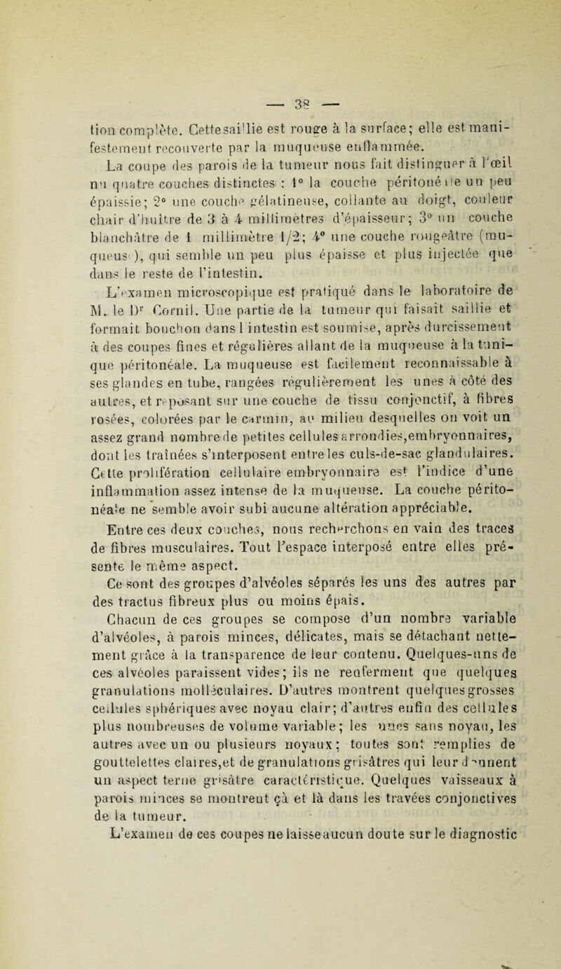 tion complète. Cettesaillie est rouge à la surface; elle est. mani¬ festement recouverte par la muqueuse enflammée. La coupe des parois de la tumeur nous fait distinguer à l'œil nu quatre couches distinctes : 1° la couche péritonéiie un peu épaissie; 2° une couche gélatineuse, collante au doigt, couleur chair d’huitre de 3 à 4- millimètres d’épaisseur; 3° un couche blanchâtre de 1 millimètre 1/2; 4° une couche rougeâtre (mu¬ queuse), qui semble un peu plus épaisse et plus injectée que dans le reste de l’intestin. L’examen microscopique est pratiqué dans le laboratoire de M. le f)r Comil. Une partie de la tumeur qui faisait saillie et formait bouchon dans 1 intestin est soumise, après durcissement à des coupes fines et régulières allant de la muqueuse à la tuni¬ que péritonéale. La muqueuse est facilement reconnaissable à ses glandes en tube, rangées régulièrement les unes à côté des autres, et ri posant sur une couche de tissu conjonctif, à fibres rosées, colorées par le carmin, au milieu desquelles on voit un assez grand nombre de petites cellules arrondies,embryonnaires, dont les traînées s’interposent entre les culs-de-sac glandulaires. Cttte prolifération cellulaire embryonnaire est l’indice d’une inflammation assez intense de la muqueuse. La couche périto¬ néale ne semble avoir subi aucune altération appréciable. Entre ces deux couches, nous recherchons en vain des traces de fibres musculaires. Tout Lespace interposé entre elles pré¬ sente le même aspect. Ce sont des groupes d’alvéoles séparés les uns des autres par des tractus fibreux plus ou moins épais. Chacun de ces groupes se compose d’un nombre variable d’alvéoles, à parois minces, délicates, mais se détachant nette¬ ment grâce à la transparence de leur contenu. Quelques-uns de ces alvéoles paraissent vides; ils ne renferment que quelques granulations moHéculaires. D’autres montrent quelques grosses cellules sphériques avec noyau clair; d’autres enfin des cellules plus nombreuses de volume variable; les unes sans noyau, les autres avec un ou plusieurs noyaux: toutes sont remplies de gouttelettes claires,et de granulations grisâtres qui leur d •muent un aspect terne grisâtre caractéristique. Quelques vaisseaux à parois minces se montrent çà et là dans les travées conjonctives de la tumeur. L’examen de ces coupes ne iaisseaucun doute sur le diagnostic