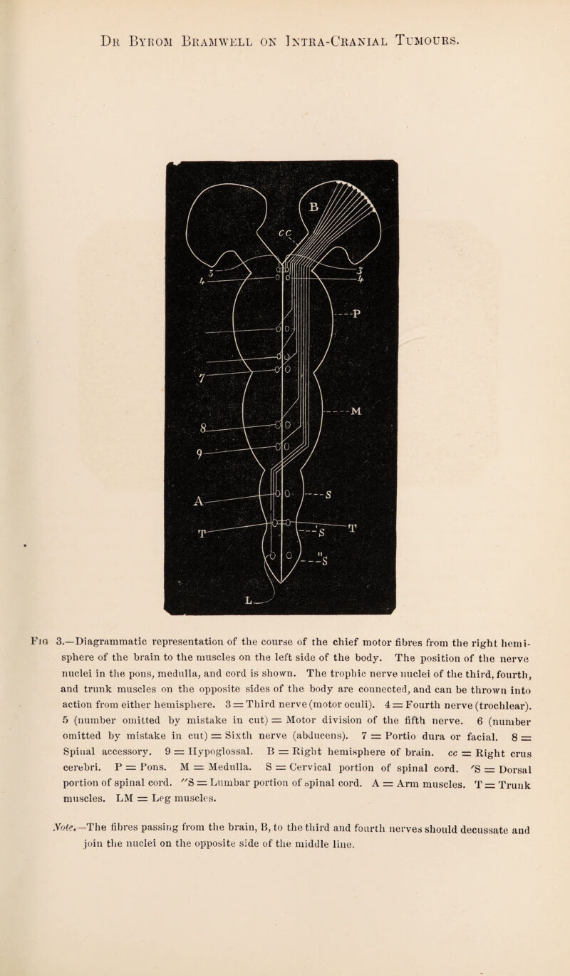 Fig 3.—Diagrammatic representation of the course of the chief motor fibres from the right hemi¬ sphere of the brain to the muscles on the left side of the body. The position of the nerve nuclei in the pons, medulla, and cord is shown. The trophic nerve nuclei of the third, fourth, and trunk muscles on the opposite sides of the body are connected, and can be thrown into action from either hemisphere. 3 = Third nerve (motor oculi). 4 = Fourth nerve (trochlear). 5 (number omitted by mistake in cut) = Motor division of the fifth nerve. 6 (number omitted by mistake in cut) = Sixth nerve (abducens). 7 = Portio dura or facial. 8 Spinal accessory. 9 = Hypoglossal. B = Right hemisphere of brain, cc = Right crus cerebri. P = Pons. M = Medulla. S = Cervical portion of spinal cord. 'S = Dorsal portion of spinal cord. 3 = Lumbar portion of spinal cord. A = Arm muscles. T = Trunk muscles. LM == Leg muscles. Note— The fibres passing from the brain, B, to the third and fourth nerves should decussate and join the nuclei on the opposite side of the middle line.