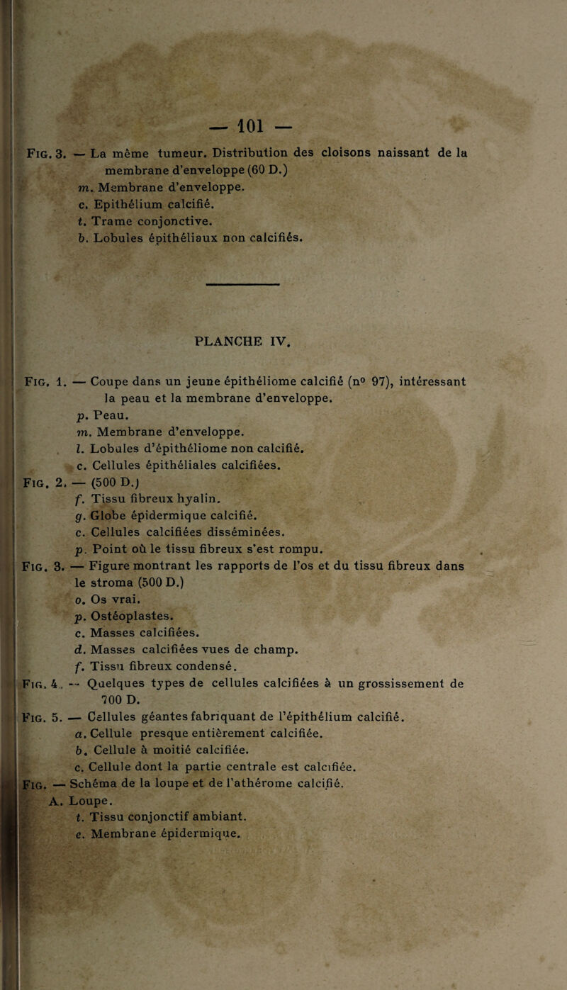 — 101 — Fig. 3. — La même tumeur. Distribution des cloisons naissant de la membrane d’enveloppe (60 D.) - gàj m. Membrane d’enveloppe. c. Epithélium calcifié. t. Trame conjonctive. b. Lobules éoithéliaux non calcifiés. PLANCHE IV. Fig, 1. — Coupe dans un jeune épithéliome calcifié (n° 97), intéressant la peau et la membrane d’enveloppe. р. Peau. m. Membrane d’enveloppe. I. Lobules d’épithéliome non calcifié. с. Cellules épithéliales calcifiées. Fig. 2. — (500 D.) f. Tissu fibreux hyalin. g. Globe épidermique calcifié, c. Cellules calcifiées disséminées. p. Point où le tissu fibreux s’est rompu. Fig. 3. — Figure montrant les rapports de l’os et du tissu fibreux dans le stroma (500 D.) o. Os vrai. p. Ostéoplastes. c. Masses calcifiées. d. Masses calcifiées vues de champ. f. Tissu fibreux condensé. Fig. 4., Quelques types de cellules calcifiées à un grossissement de 700 D. a. Cellule presque entièrement calcifiée. b. Cellule à moitié calcifiée. c. Cellule dont la partie centrale est calcifiée. | Fig. — Schéma de la loupe et de l’athérome calcifié. A. Loupe. t. Tissu conjonctif ambiant. e. Membrane épidermique. -s