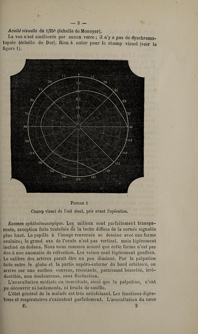 Acuité visuelle de l/25e (échelle de Monoyer). La vue n’est améliorée par aucun verre ; il n*y a pas de dyschroma¬ topsie (échelle de Dor). Rien à noter pour le champ visuel (voir la figure 1). Figure 1 Champ visuel de l'œil droit, pris avant l’opération. Examen ophthalmoscopique. Les milieux sont parfaitement transpa¬ rents, exception faite toutefois de la tache diffuse de la cornée signalée plus haut. La papille à l’image renversée se dessine avec une forme ovalaire; le grand axe de l’ovale n’est pas vertical, mais légèrement incliné en dedans. Nous nous sommes assuré que cette forme n’est pas due à une anomalie de réfraction. Les veines sont légèrement gonflées. Le calibre des artères paraît être un peu diminué. Par la palpation faite entre le globe et la partie supéro-externe’ du bord orbitaire, on arrive sur une surface convexe, résistante, paraissant bosselée, irré¬ ductible, non douloureuse, sans fluctuation. L’auscultation médiate ou immédiate, ainsi que la palpation, n’ont pu découvrir ni battements, ni bruits de souffle. L’état général de la malade est très satisfaisant. Les fonctions diges¬ tives et respiratoires s’exécutent parfaitement. L’auscultation du cœur E. 2