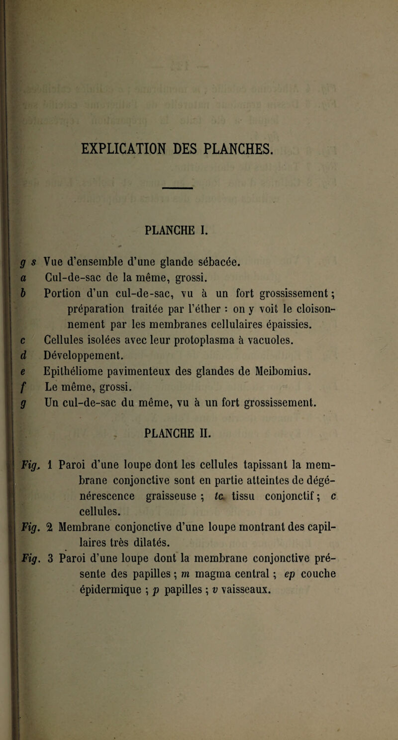 EXPLICATION DES PLANCHES. PLANCHE I. g s Vue d’ensemble d’une glande sébacée. a Cul-de-sac de la même, grossi. b Portion d’un cul-de-sac, vu à un fort grossissement ; préparation traitée par l’éther : on y voit le cloison¬ nement par les membranes cellulaires épaissies. c Cellules isolées avec leur protoplasma à vacuoles. d Développement. e Epithéliome pavimenteux des glandes de Meibomius. f Le même, grossi. g Un cul-de-sac du même, vu à un fort grossissement. PLANCHE IL Fig, 1 Paroi d’une loupe dont les cellules tapissant la mem¬ brane conjonctive sont en partie atteintes de dégé¬ nérescence graisseuse ; le tissu conjonctif ; c cellules. Fig. 2 Membrane conjonctive d’une loupe montrant des capil¬ laires très dilatés. Fig. 3 Paroi d’une loupe dont la membrane conjonctive pré¬ sente des papilles ; m magma central ; ep couche épidermique ; p papilles ; v vaisseaux.