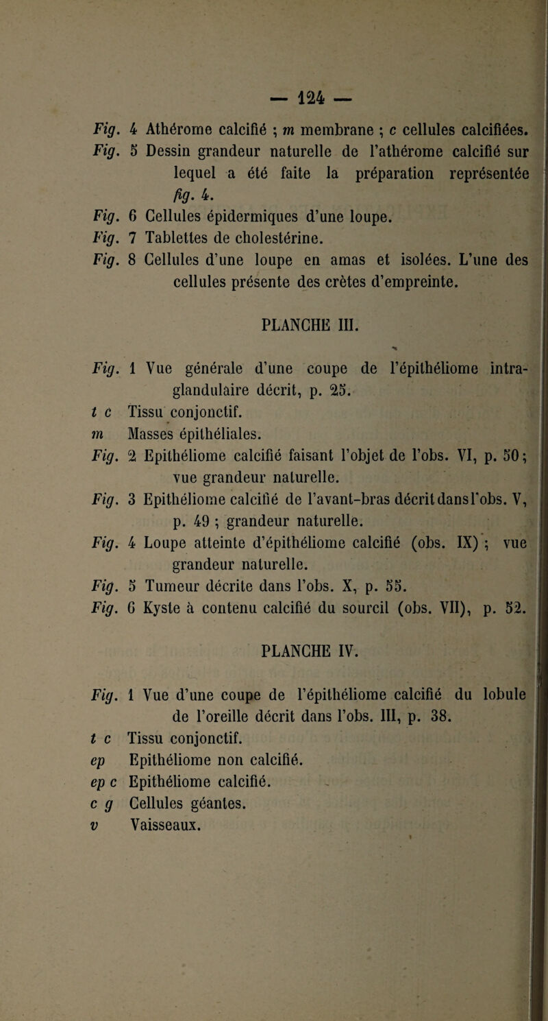 Fig. 4 Athérome calcifié ; m membrane ; c cellules calcifiées. Fig. 5 Dessin grandeur naturelle de l’athérome calcifié sur lequel a été faite la préparation représentée fig- 4. Fig. 6 Cellules épidermiques d’une loupe. Fig. 7 Tablettes de cholestérine. Fig. 8 Cellules d’une loupe en amas et isolées. L’une des cellules présente des crêtes d’empreinte. PLANCHE III. Fig. 1 Vue générale d’une coupe de l’épithéliome intra- glandulaire décrit, p. 25. t c Tissu conjonctif. m Masses épithéliales. Fig. 2 Epithéliome calcifié faisant l’objet de l’obs. VI, p. 50; vue grandeur naturelle. Fig. 3 Epithéliome calcifié de l’avant-bras décrit dansTobs. V, p. 49 ; grandeur naturelle. Fig. 4 Loupe atteinte d’épithéliome calcifié (obs. IX) ; vue grandeur naturelle. Fig. 5 Tumeur décrite dans l’obs. X, p. 55. Fig. G Kyste à contenu calcifié du sourcil (obs. VII), p. 52. PLANCHE IV. Fig. 1 Vue d’une coupe de l’épithéliome calcifié du lobule de l’oreille décrit dans l’obs. III, p. 38. t c Tissu conjonctif. ep Epithéliome non calcifié. ep c Epithéliome calcifié. c g Cellules géantes. v Vaisseaux.