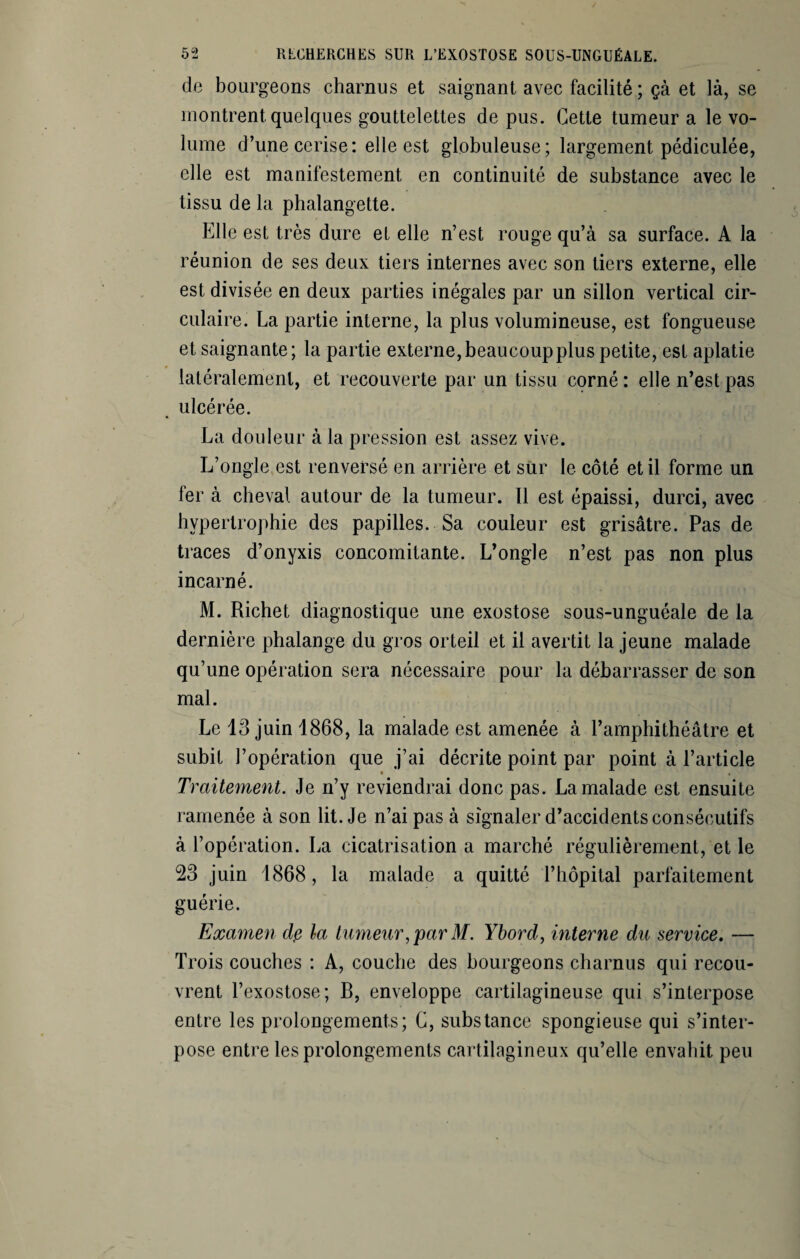 de bourgeons charnus et saignant avec facilité; çà et là, se montrent,quelques gouttelettes de pus. Cette tumeur a le vo¬ lume d’une cerise: elle est globuleuse; largement pédiculée, elle est manifestement en continuité de substance avec le tissu de la phalangette. Elle est très dure et elle n’est rouge qu’à sa surface. A la réunion de ses deux tiers internes avec son tiers externe, elle est divisée en deux parties inégales par un sillon vertical cir¬ culaire. La partie interne, la plus volumineuse, est fongueuse et saignante; la partie externe, beaucoup plus petite, est aplatie latéralement, et recouverte par un tissu corné : elle n’est pas ulcérée. La douleur à la pression est assez vive. L’ongle est renversé en arrière et sur le côté et il forme un 1er à cheval autour de la tumeur. Il est épaissi, durci, avec hypertrophie des papilles. Sa couleur est grisâtre. Pas de traces d’onyxis concomitante. L’ongle n’est pas non plus incarné. M. Richet diagnostique une exostose sous-unguéale de la dernière phalange du gros orteil et il avertit la jeune malade qu’une opération sera nécessaire pour la débarrasser de son mal. Le 13 juin 1868, la malade est amenée à l’amphithéâtre et subit l’opération que j’ai décrite point par point à l’article * Traitement. Je n’y reviendrai donc pas. La malade est ensuite ramenée à son lit. Je n’ai pas à signaler d’accidents consécutifs à l’opération. La cicatrisation a marché régulièrement, et le 23 juin 1868, la malade a quitté l’hôpital parfaitement guérie. Examen de la tumeur, par M. Ybord, interne du service. — Trois couches : A, couche des bourgeons charnus qui recou¬ vrent l’exostose; B, enveloppe cartilagineuse qui s’interpose entre les prolongements; G, substance spongieuse qui s’inter¬ pose entre les prolongements cartilagineux qu’elle envahit peu