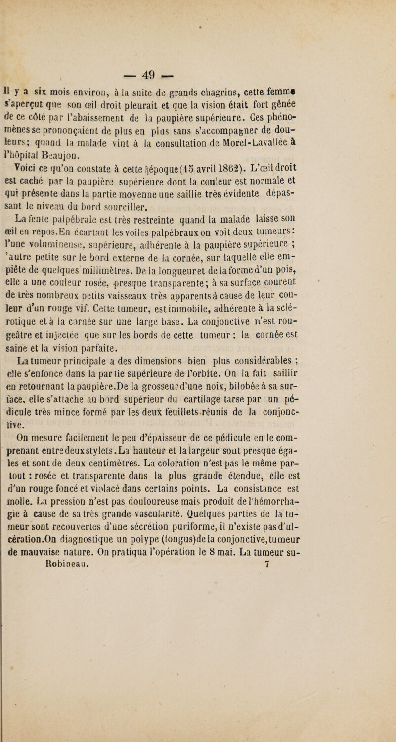 Il y a six mois environ, à ia suite de grands chagrins, cette femm« s’aperçut que son œil droit pleurait et que la vision était fort gênée de ce côté par l’abaissement de la paupière supérieure. Ges phéno¬ mènes se prononçaient de plus en plus sans s’accompagner de dou¬ leurs; quand la malade vint à la consultation de Morel-Lavallée à l’hôpital Beaujon. Voici ce qu’on constate à cette ^époque (15 avril 1862). L’œil droit est caché par la paupière supérieure dont la couleur est normale et qui présente dans la partie moyenne une saillie très évidente dépas¬ sant le niveau du bord sourciller. La fente palpébrale est très restreinte quand la malade laisse son œil en repos.En écartant les voiles palpébraux on voit deux tumeurs: l’une volumineuse, supérieure, adhérente à la paupière supérieure ; ’aulre petite sur le bord externe de la cornée, sur laquelle elle em¬ piète de quelques millimètres. De la longueur et de la forme d’un pois, elle a une couleur rosée, presque transparente; à sa surface courent de très nombreux petits vaisseaux très apparents à cause de leur cou¬ leur d’un rouge vif. Cette tumeur, estimmobile, adhérente à la sclé¬ rotique et à la cornée sur une large base. La conjonctive n’est rou¬ geâtre et injectée que sur les bords de cette tumeur ; la cornée est saine et la vision parfaite. La tumeur principale a des dimensions bien plus considérables ; elle s’enfonce dans la partie supérieure de l’orbite. On la fait saillir en retournant la paupière.De la grosseur d’une noix, bilobéeà sa sur¬ face, elle s’attache au bord supérieur du cartilage tarse par un pé¬ dicule très mince formé par les deux feuillets réunis de la conjonc¬ tive. On mesure facilement le peu d’épaisseur de ce pédicule en le com¬ prenant entre deux stylets. La hauteur et la largeur sont presque éga¬ ies et sont de deux centimètres. La coloration n'est pas le même par¬ tout : rosée et transparente dans la plus grande étendue, elle est d’un rouge foncé et violacé dans certains points. La consistance est molle. La pression n’est pas douloureuse mais produit de l’hémorrha¬ gie à cause de sa très grande vascularité. Quelques parties de la tu¬ meur sont recouvertes d’une sécrétion puriforme, il n’existe pasd’ul- céralion.On diagnostique un polype (longus)de la conjonctive,tumeur de mauvaise nature. On pratiqua l’opération le 8 mai. La tumeur su- Robineau. 7