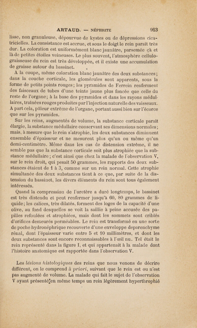lisse, non granuleuse, dépourvue de kystes ou de dépressions cica¬ tricielles. La consistance est accrue, et sous le doigt le rein paraît très dur. La coloration est uniformément blanc jaunâtre, parsemée çà et là de petites étoiles veineuses. Le plus souvent, l’atmosphère cellulo- graisseuse du rein est très développée, et il existe une accumulation de graisse autour du bassinet. A la coupe, même coloration blanc jaunâtre des deux substances; dans la couche corticale, les glomérules sont apparents, sous la forme de petits points rouges ; les pyramides de Ferrein renferment des faisceaux de tubes d’une teinte jaune plus foncée que celle du reste de l’organe; à la base des pyramides et dans les rayons médul¬ laires, traînées rouges produites par l’inj ection naturelle des vaisseaux. A part cela, pâleur extrême de l’organe, portant aussi bien sur l’écorce que sur les pyramides. Sur les reins, augmentés de volume, la substance corticale paraît élargie, la substance médullaire conservant ses dimensions normales; mais, à mesure que le,rein s’atrophie, les deux substances diminuent ensemble d’épaisseur et ne mesurent plus qu’un ou même qu’un demi-centimètre. Même dans les cas de distension extrême, il ne semble pas que la substance corticale soit plus atrophiée que la sub¬ stance médullaire ; c’est ainsi que chez la malade de l’observation Y, sur le rein droit, qui pesait 50 grammes, les rapports des deux sub¬ stances étaient de 1 à 3, comme sur un rein normal. Cette atrophie simultanée des deux substances tient à ce que, par suite de la dis¬ tension du bassinet, les divers éléments du rein sont tous également intéressés. Quand la compression de l’uretère a duré longtemps, le bassinet est très distendu et peut renfermer jusqu’à 60, 80 grammes de li¬ quide; les calices, très dilatés, forment des loges de la capacité d’une olive, au fond desquelles se voit la saillie à peine accusée des pa¬ pilles refoulées et atrophiées, mais dont les sommets sont criblés d’orifices demeurés perméables. Le rein est transformé en une sorte de poche hydronéphrique recouverte d’une enveloppe deparenchyme rénal, dont l’épaisseur varie entre 5 et 10 millimètres, et dont les deux substances sont encore reconnaissables à l’œil nu. Tel était le rein représenté dans la figure I, et qui appartenait à la malade dont l’histoire anatomique est rapportée dans l’observation Y. Les lésions histologiques des reins que nous venons de décrire différent, on le comprend à priori, suivant que le rein est ou n’est pas augmenté de volume. La malade qui fait le sujet de l’observation V ayant présentéfen même temps un rein légèrement hyperthrophié