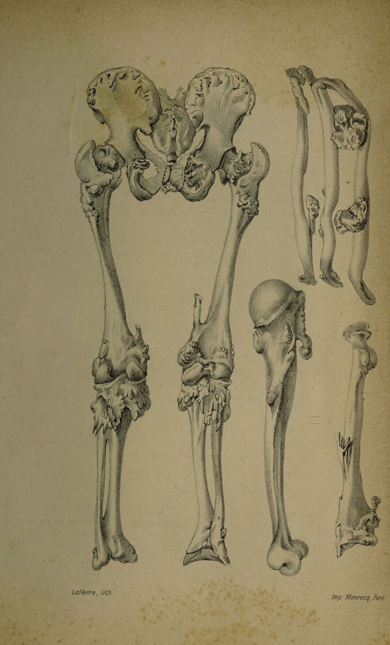 lmp. Monrocq. Pins * y Lefèvre, Uth.