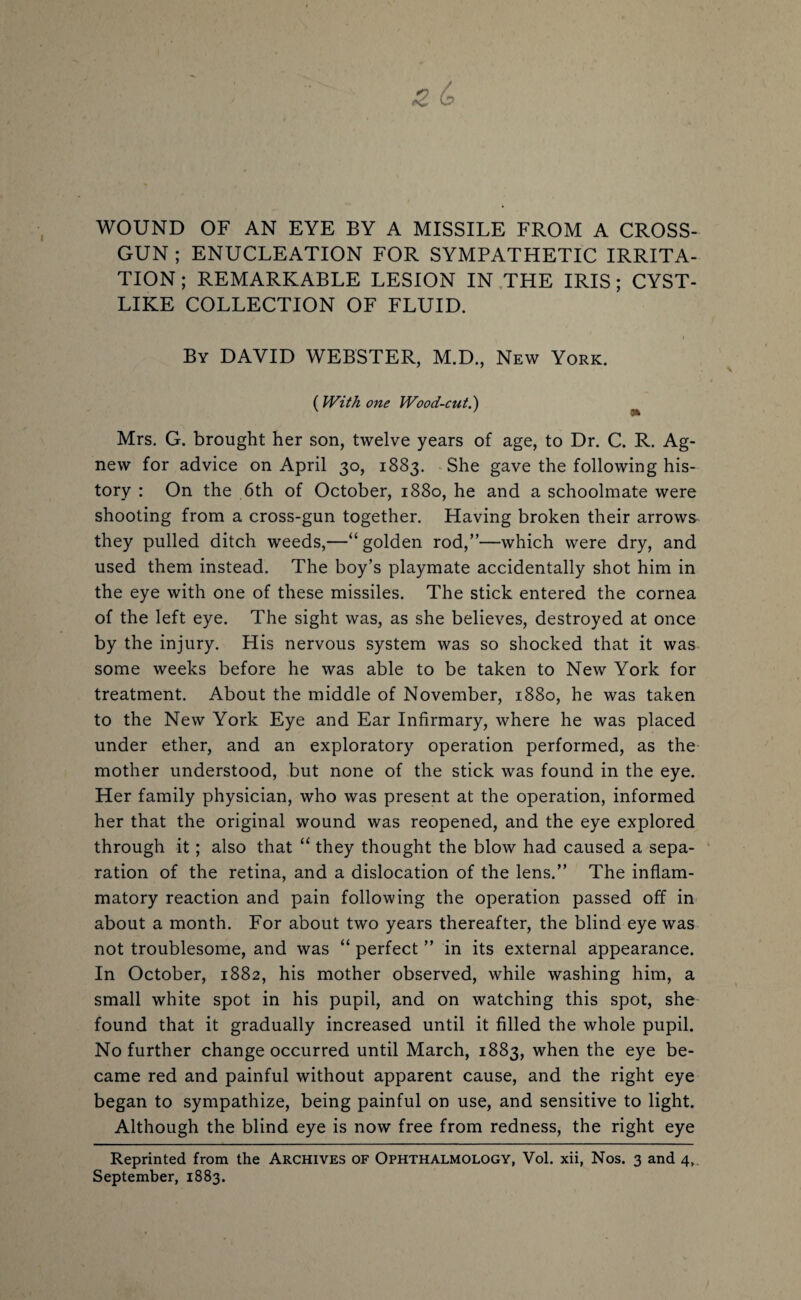 WOUND OF AN EYE BY A MISSILE FROM A CROSS¬ GUN ; ENUCLEATION FOR SYMPATHETIC IRRITA¬ TION ; REMARKABLE LESION IN THE IRIS ; CYST¬ LIKE COLLECTION OF FLUID. i By DAVID WEBSTER, M.D., New York. (With one Wood-cut.') Mrs. G. brought her son, twelve years of age, to Dr. C. R. Ag- new for advice on April 30, 1883. She gave the following his¬ tory : On the 6th of October, 1880, he and a schoolmate were shooting from a cross-gun together. Having broken their arrows they pulled ditch weeds,—“golden rod,”—which were dry, and used them instead. The boy’s playmate accidentally shot him in the eye with one of these missiles. The stick entered the cornea of the left eye. The sight was, as she believes, destroyed at once by the injury. His nervous system was so shocked that it was some weeks before he was able to be taken to New York for treatment. About the middle of November, 1880, he was taken to the New York Eye and Ear Infirmary, where he was placed under ether, and an exploratory operation performed, as the mother understood, but none of the stick was found in the eye. Her family physician, who was present at the operation, informed her that the original wound was reopened, and the eye explored through it; also that “ they thought the blow had caused a sepa¬ ration of the retina, and a dislocation of the lens.” The inflam¬ matory reaction and pain following the operation passed off in about a month. For about two years thereafter, the blind eye was not troublesome, and was “ perfect ” in its external appearance. In October, 1882, his mother observed, while washing him, a small white spot in his pupil, and on watching this spot, she found that it gradually increased until it filled the whole pupil. No further change occurred until March, 1883, when the eye be¬ came red and painful without apparent cause, and the right eye began to sympathize, being painful on use, and sensitive to light. Although the blind eye is now free from redness, the right eye Reprinted from the Archives of Ophthalmology, Vol. xii, Nos. 3 and 4, September, 1883.