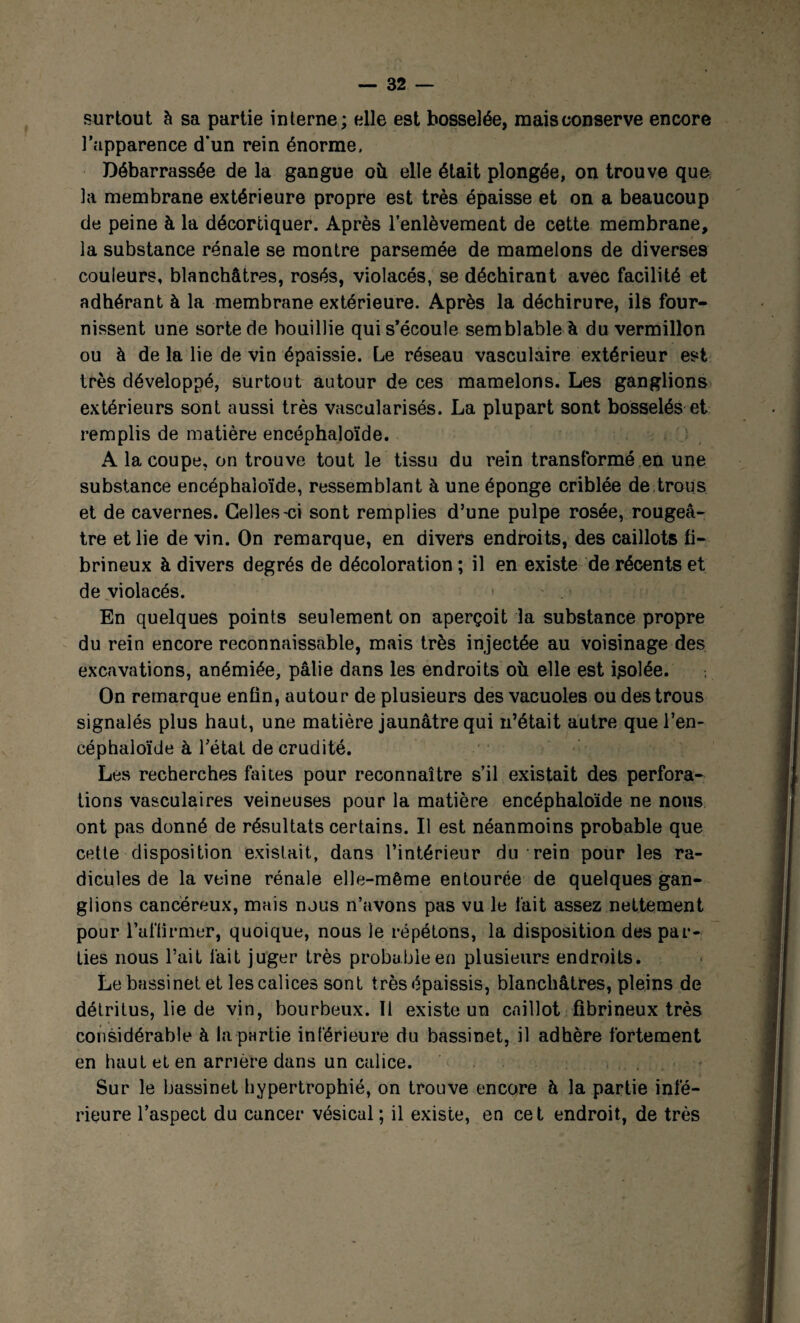 surtout à sa partie interne; elle est bosselée, mais conserve encore l’apparence d'un rein énorme. Débarrassée de la gangue oîi elle était plongée, on trouve que la membrane extérieure propre est très épaisse et on a beaucoup de peine à la décortiquer. Après l’enlèvement de cette membrane, la substance rénale se montre parsemée de mamelons de diverses couleurs, blanchâtres, rosés, violacés, se déchirant avec facilité et adhérant à la membrane extérieure. Après la déchirure, ils four¬ nissent une sorte de bouillie qui s’écoule semblable à du vermillon ou à de la lie de vin épaissie. Le réseau vasculaire extérieur est très développé, surtout autour de ces mamelons. Les ganglions extérieurs sont aussi très vascularisés. La plupart sont bosselés et remplis de matière encéphaloïde. A la coupe, on trouve tout le tissu du rein transformé en une substance encéphaloïde, ressemblant à une éponge criblée de trous et de cavernes. Celles-ci sont remplies d’une pulpe rosée, rougeâ¬ tre et lie de vin. On remarque, en divers endroits, des caillots fi¬ brineux à divers degrés de décoloration ; il en existe de récents et de violacés. En quelques points seulement on aperçoit la substance propre du rein encore reconnaissable, mais très injectée au voisinage des excavations, anémiée, pâlie dans les endroits où elle est isolée. On remarque enfin, autour de plusieurs des vacuoles ou des trous signalés plus haut, une matière jaunâtre qui n’était autre que l’en* céphaloïde à l’état de crudité. Les recherches faites pour reconnaître s’il existait des perfora¬ tions vasculaires veineuses pour la matière encéphaloïde ne nous ont pas donné de résultats certains. Il est néanmoins probable que cette disposition existait, dans l’intérieur du rein pour les ra¬ dicules de la veine rénale elle-même entourée de quelques gan¬ glions cancéreux, mais nous n’avons pas vu le fait assez nettement pour l’affirmer, quoique, nous le répétons, la disposition des par¬ ties nous l’ait lait juger très probable en plusieurs endroits. Le bassinet et les calices sont très épaissis, blanchâtres, pleins de détritus, lie de vin, bourbeux. 11 existe un caillot fibrineux très considérable à bipartie inférieure du bassinet, il adhère fortement en haut et en arrière dans un calice. Sur le bassinet hypertrophié, on trouve encore à la partie infé¬ rieure l’aspect du cancer vésical; il existe, en cet endroit, de très