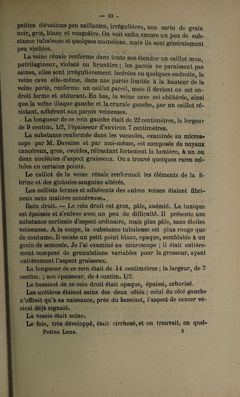 petites élévations peu saillantes, irrégulières, une sorte de grain noir, gris, blanc et rougeâtre. On voit enfin,encore un peu de sub¬ stance tubuleuse et quelques mamelons, mais ils sont généralement peu visibles. * * ; . f • ' ' ) •' f • ' ' ' * 1 . 1 ~ ^ ~ . t r . . 4 , , * La veine rénale renferme dans toute son étendue un caillot mou, putrilagineux, violacé ou brunâtre ; les parois ne paraissent pas saines, elles sont irrégulièrement lacérées en quelques endroits, la veine cave elle-même, dans une partie limitée à la hauteur de la veine porte, renferme un caillot pareil, mais il devient en cet en¬ droit ferme et obturant. En bas, la veine cave est oblitérée, ainsi que la vefne iliaque gauche et la crurale gauche, par un caillot ré¬ sistant, adhérant aux parois veineuses. La longueur de ce rein gauche, était de 22centimètres, la largeur de 9 centim. 1/2, l’épaisseur d’environ 7 centimètres. La substance renfermée dans les vacuoles, examinée au micros¬ cope par M. Davaine et par moi-même, est composée de noyaux cancéreux, gros, ovoïdes, rétractant fortement.la lumière, à un ou deux nucléoles d’aspect graisseux. On a trouvé quelques rares cel¬ lules en certains points. Le caillot de la veine rénale renfermait les éléments de la fi¬ brine et des globules sanguins altérés. Les caillots fermes et adhérents des autres veines étaient fîbri- \ neux sans matière cancéreuse. Rein droit. — Le rein droit est gros, pâle, anémié. La tunique est épaissie et s’enlève avec un peu de difficulté. Il présente une substance corticale d’aspeGt ordinaire, mais plus pâle, sans étoiles veineuses. A la coupe, la substance tubuleuse est plus rouge que de coutume. Il existe un petit point blanc, opaque, semblable à un grain de semoule. Je l’ai examiné au microscope ; il était entière¬ ment composé de granulations variables pour la grosseur, ayant entièrement l’aspect graisseux. La longueur de ce rein était de 14 centimètres ; la largeur, de 7 centim. ; son épaisseur, de 4 centim. 1/2. • Le bassinet de ce rein droit était opaque, épaissi, arborisé. Les urétères étaient sains des deux côtés ; celui du côté gauche n’offrait qu’à sa naissance, près du bassinet, l’aspect de cancer vé¬ sical déjà signalé. - / La vessie était saine. Le foie, très développé, était cirrhosé, et on trouvait, en quel- Patino Luna. 5