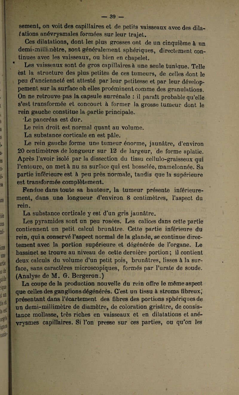tations anévrysmales formées sur leur trajet. Ges dilatations, dont les plus grosses ont de un cinquième à un demi-millimètre, sont généralement sphériques, directement con¬ tinues avec les vaisseaux, ou bien en chapelet. Les vaisseaux sont de gros capillaires à une seule tum'aue. Telle est la structure des plus petites de ces tumeurs, de celles dont le peu d’ancienneté est attesté par leur petitesse et par leur dévelop¬ pement sur la surface où elles proéminent comme des granulations. On ne retrouve pas la capsule surrénale : il paraît probable qu’elle s’est transformée et concourt à former la grosse tumeur dont le rein gauche constitue la partie principale. *Le pancréas est dur. Le rein droit est normal quant au volume. La substance corticale en est pâle. Le rein gauche forme une tumeur énorme, jaunâtre, d’environ 20 centimètres de longueur sur 12 de largeur, de forme aplatie. Après l’avoir isolé par la dissection du tissu cellulo-graisseux qui l’entoure, on met à nu sa surface qui est bosselée, mamelonnée. Sa partie inférieure est à peu près normale, tandis que la supérieure est transformée complètement. Fendue dans toute sa hauteur, la tumeur présente inférieure¬ ment, dans une longueur d’environ 8 centimètres, l’aspect du rein. La substance corticale y est d’un gris jaunâtre. Les pyramides sont un peu rosées. Les calices dans cette partie contiennent un petit calcul brunâtre. Cette partie inférieure du rein, qui a conservé l’aspect normal de la glande, se continue direc¬ tement avec la portion supérieure et dégénérée de l’organe. Le bassinet se trouve au niveau de cette dernière portion; il contient deux calculs du volume d’un petit pois, brunâtres, lisses à la sur¬ face, sans caractères microscopiques, formés par l’urate de soude. (Analyse de M. G-. Bergeron.) La coupe de la production nouvelle du rein offre le même aspect que celles des ganglions dégénérés. C’est un tissu à stroma fibreux,' présentant dans l’écartement des fibres des portions sphériques de un demi-millimètre de diamètre, de coloration grisâtre, de consis¬ tance mollasse, très riches en vaisseaux et en dilatations et ané¬ vrysmes capillaires. Si l’on presse sur ces parties, ou qu’on les