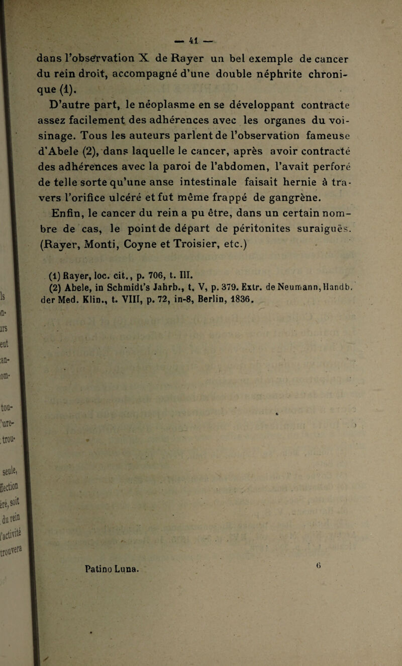 dans l’obsefrvation X de Rayer un bel exemple de cancer du rein droit, accompagné d’une double néphrite chroni¬ que (1). D’autre part, le néoplasme en se développant contracte assez facilement des adhérences avec les organes du voi¬ sinage. Tous les auteurs parlent de l’observation fameuse d’Abele (2), dans laquelle le cancer, après avoir contracté des adhérences avec la paroi de l’abdomen, l’avait perforé de telle sorte qu’une anse intestinale faisait hernie à tra¬ vers l’orifice ulcéré et fut même frappé de gangrène. Enfin, le cancer du rein a pu être, dans un certain nom¬ bre de cas, le point de départ de péritonites suraiguës. (Rayer, Monti, Coyne et Troisier, etc.) (1) Rayer, loc. cit., p. 706, t. III. (2) Abele, in Schmidt’s Jahrb., t, V, p. 379. Extr. de Neumann, Handb. der Med. Klin., t. VIII, p. 72, in-8, Berlin, 1836. Patino Luna. 6