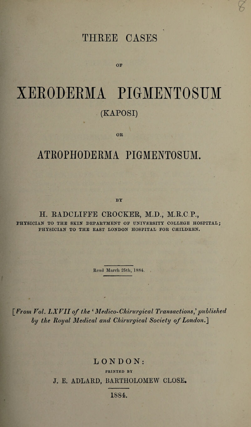 THREE CASES OF XEEODEBMA PIGMENTOSUM (KAPOSI) OR ATROPHODERMA PIGMENTOSUM. BY H. RADCLIFFE CROCKER, M.D., M.R.C P, PHYSICIAN TO THE SKIN DEPARTMENT OF UNIVERSITY COLLEGE HOSPITAL; PHYSICIAN TO THE EAST LONDON HOSPITAL FOR CHILDREN. Rend March 25th, 1884. [ From Vol. LXVII of the ‘ Medico-Chiruryical Transactions,'published by the Royal Medical and Chirurgical Society of London.] LONDON; PRINTED BY J. E. ADLARD, BARTHOLOMEW CLOSE. 1884.