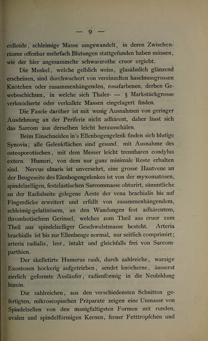 colloide, schleimige Masse umgewandelt, in deren Zwischen¬ räume offenbar mehrfach Blutungen stattgefunden haben müssen, wie der hier angesammelte schwarzrothe cruor ergiebt. Die Muskel, welche gelblich weiss, glasähnlich glänzend erscheinen, sind durchwuchert von vereinzelten haselnussgrossen Knötchen oder zusammenhängenden, rosafarbenen, derben Ge- websschichten, in welche sich Thaler-5 Markstückgrosse verknöcherte oder verkalkte Massen eingelagert finden. Die Fascie darüber ist mit wenig Ausnahmen von geringer Ausdehnung an der Periferie nicht adhärent, daher lässt sich das Sarcom aus derselben leicht herausschälen. Beim Einschneiden in’s Ellenbogengelenk finden sich blutige Synovia; alle Gelenkflächen sind gesund, mit Ausnahme des osteoporotischen, mit dem Messer leicht trennbaren condylus extern. Humeri, von dem nur ganz minimale Reste erhalten sind. Nervus ulnaris ist unversehrt, eine grosse Hautvene an der Beugeseite des Elenbogengelenkes ist von der myxomatösen, spindelzelligen, festelastischen Sarcommasse obturirt, sämmtliche an der Radialseite gelegene Aeste der vena brachialis bis auf Fingerdicke erweitert und erfüllt von zusammenhängendem, schleimig-gelatinösem, an den Wandungen fest adhärentem, thrombotischem Gerinsel, welches zum Theil aus cruor zum Theil aus spindelzelliger Geschwulstmasse besteht. Arteria brachialis ist bis zur Ellenbeuge normal, nur seitlich comprimirt; arteria radialis, leer, intakt und gleichfalls frei von Sarcom- parthien. Der skelletirte Humerus rauh, durch zahlreiche, warzige Exostosen höckerig aufgetrieben, sendet knöcherne, äusserst zierlich geformte Ausläufer, radienförmig in die Neubildung hinein. Die zahlreichen, aus den verschiedensten Schnitten ge¬ fertigten, mikroscopischen Präparate zeigen eine Unmasse von Spindelzellen von den manigfaltigsten Formen mit runden, ovalen und spindelförmigen Kernen, ferner Fetttröpfchen und