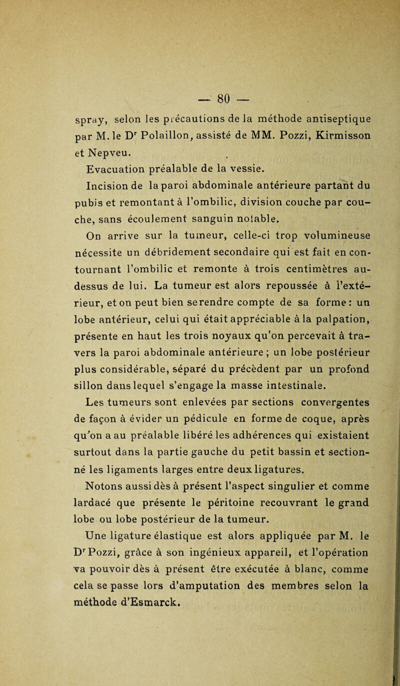 spray, selon les précautions de la méthode antiseptique par M.le Dr Polaillon, assisté de MM. Pozzi, Kirmisson et Nepveu. Evacuation préalable de la vessie. Incision de la paroi abdominale antérieure partant du pubis et remontant à l’ombilic, division couche par cou¬ che, sans écoulement sanguin notable. On arrive sur la tumeur, celle-ci trop volumineuse ■\ nécessite un débridement secondaire qui est fait en con¬ tournant l’ombilic et remonte à trois centimètres au- dessus de lui. La tumeur est alors repoussée à l’exté¬ rieur, et on peut bien serendre compte de sa forme: un lobe antérieur, celui qui était appréciable à la palpation, présente en haut les trois noyaux qu’on percevait à tra¬ vers la paroi abdominale antérieure ; un lobe postérieur plus considérable, séparé du précèdent par un profond sillon dans lequel s’engage la masse intestinale. Les tumeurs sont enlevées par sections convergentes de façon à évider un pédicule en forme de coque, après qu’on a au préalable libéré les adhérences qui existaient surtout dans la partie gauche du petit bassin et section¬ né les ligaments larges entre deux ligatures. Notons aussi dès à présent l’aspect singulier et comme lardacé que présente le péritoine recouvrant le grand lobe ou lobe postérieur de la tumeur. Une ligature élastique est alors appliquée par M. le Dr Pozzi, grâce à son ingénieux appareil, et l’opération va pouvoir dès à présent être exécutée à blanc, comme cela se passe lors d’amputation des membres selon la méthode d’Esmarck.